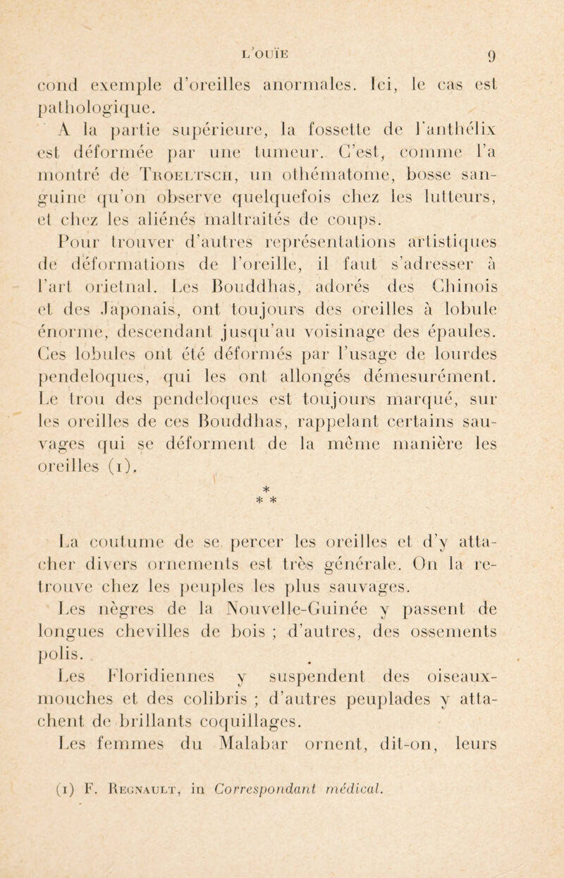 coud exemple d’oreilles anormales. Ici, le cas est pat hologique. A la partie supérieure, la fossette de l’anthélix est déformée par une tumeur. C’est, comme l’a montré de Troeltsch, un othématome, bosse san¬ guine qu’on observe quelquefois chez les lutteurs, et chez les aliénés maltraités de coups. Pour trouver d’autres représentations artistiques de déformations de l’oreille, il faut s'adresser à l’art orietnal. Les Bouddhas, adorés des Chinois et des Japonais, ont toujours des oreilles à lobule énorme, descendant jusqu’au voisinage des épaules. Ces lobules ont été déformés par l’usage de lourdes pendeloques, qui les ont allongés démesurément. Le trou des pendeloques est toujours marqué, sur les oreilles de ces Bouddhas, rappelant certains sau¬ vages qui se déforment de la meme manière les oreilles (i). * * * La coutume de se percer les oreilles et d'y atta¬ cher divers ornements est très générale. On la re¬ trouve chez les peuples les plus sauvages. Les nègres de la Nouvelle-Guinée y passent de longues chevilles de bois ; d’autres, des ossements polis. Les Floridiennes y suspendent des oiseaux- mouches et des colibris ; d’autres peuplades y atta¬ chent de brillants coquillages. Les femmes du Malabar ornent, dit-on, leurs (i) F. Régnault, in Correspondant médical.