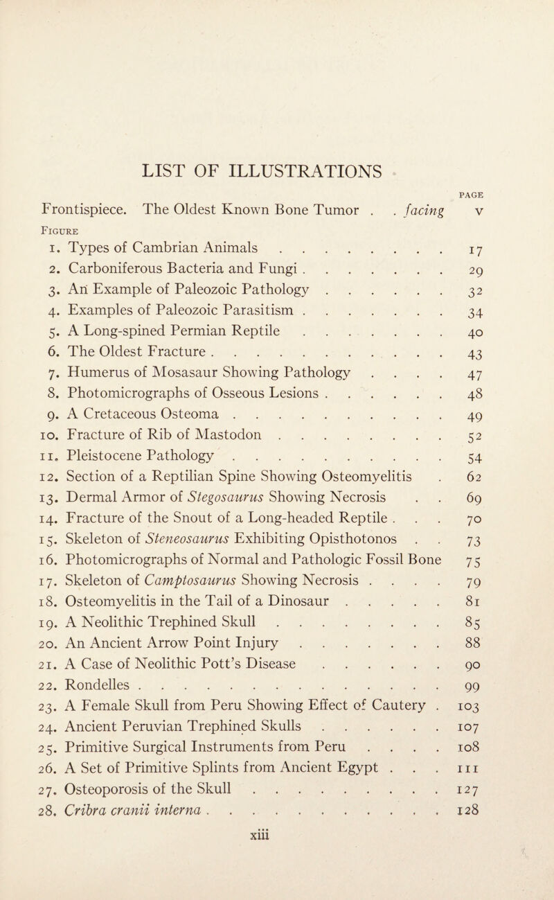 LIST OF ILLUSTRATIONS PAGE Frontispiece. The Oldest Known Bone Tumor . . facing v Figure 1. Types of Cambrian Animals.17 2. Carboniferous Bacteria and Fungi.29 3. An Example of Paleozoic Pathology.32 4. Examples of Paleozoic Parasitism.34 5. A Long-spined Permian Reptile.40 6. The Oldest Fracture.43 7. Humerus of Mosasaur Showing Pathology .... 47 8. Photomicrographs of Osseous Lesions.48 9. A Cretaceous Osteoma.49 10. Fracture of Rib of Mastodon.52 11. Pleistocene Pathology.54 12. Section of a Reptilian Spine Showing Osteomyelitis . 62 13. Dermal Armor of Stegosaurus Showing Necrosis . . 69 14. Fracture of the Snout of a Long-headed Reptile ... 70 15. Skeleton of Steneosaurus Exhibiting Opisthotonos . . 73 16. Photomicrographs of Normal and Pathologic Fossil Bone 75 17. Skeleton of Camptosaurus Showing Necrosis .... 79 18. Osteomyelitis in the Tail of a Dinosaur.81 19. A Neolithic Trephined Skull.85 20. An Ancient Arrow Point Injury.88 21. A Case of Neolithic Pott’s Disease.90 22. Rondelles.99 23. A Female Skull from Peru Showing Effect of Cautery . 103 24. Ancient Peruvian Trephined Skulls.107 25. Primitive Surgical Instruments from Peru . . . . 108 26. A Set of Primitive Splints from Ancient Egypt . . . hi 27. Osteoporosis of the Skull.127 28. Cribra cranii interna.128