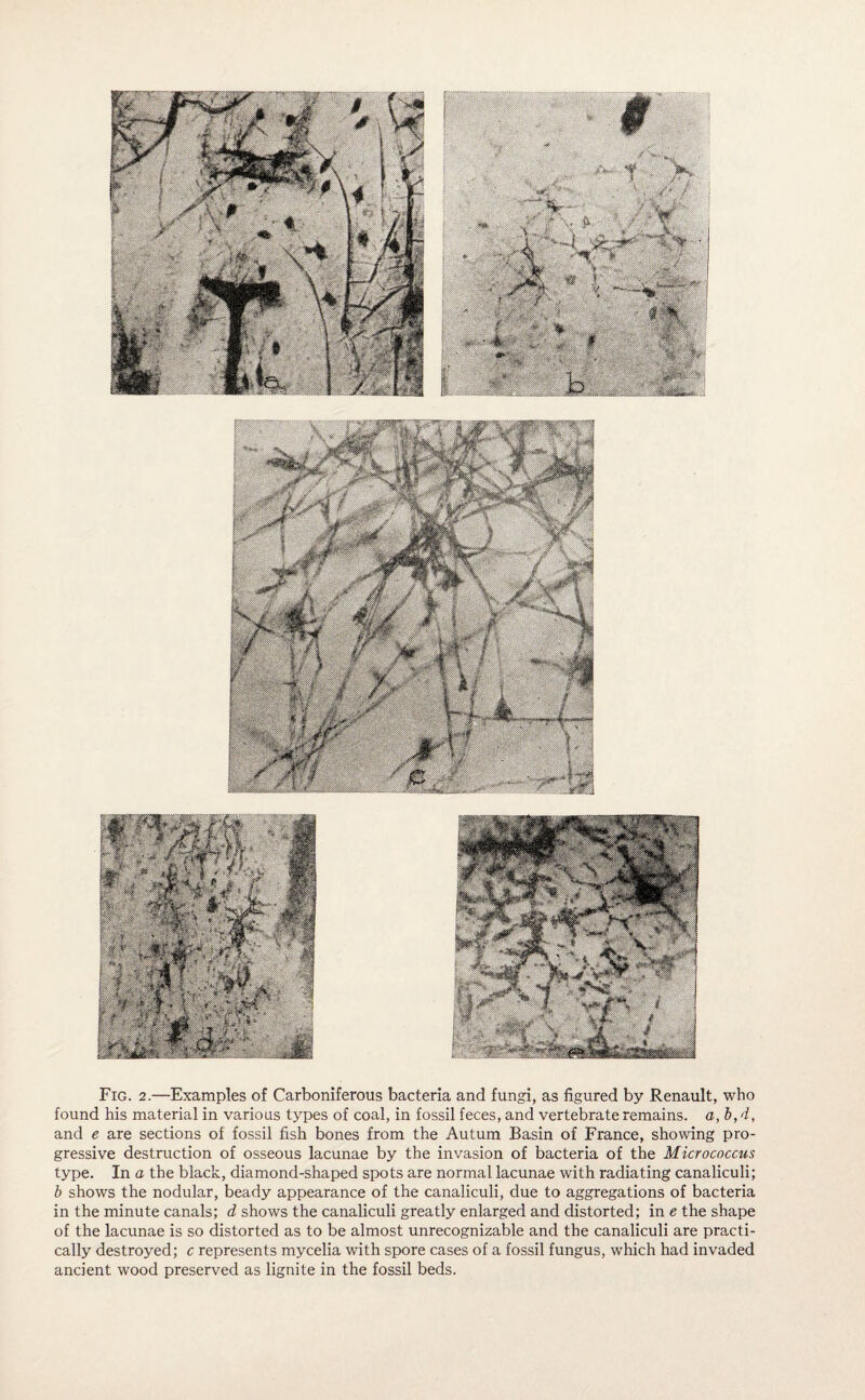 Fig. 2.—Examples of Carboniferous bacteria and fungi, as figured by Renault, who found his material in various types of coal, in fossil feces, and vertebrate remains, a, b,d, and e are sections of fossil fish bones from the Autum Basin of France, showing pro¬ gressive destruction of osseous lacunae by the invasion of bacteria of the Micrococcus type. In a the black, diamond-shaped spots are normal lacunae with radiating canaliculi; b shows the nodular, beady appearance of the canaliculi, due to aggregations of bacteria in the minute canals; d shows the canaliculi greatly enlarged and distorted; in e the shape of the lacunae is so distorted as to be almost unrecognizable and the canaliculi are practi¬ cally destroyed; c represents mycelia with spore cases of a fossil fungus, which had invaded ancient wood preserved as lignite in the fossil beds.