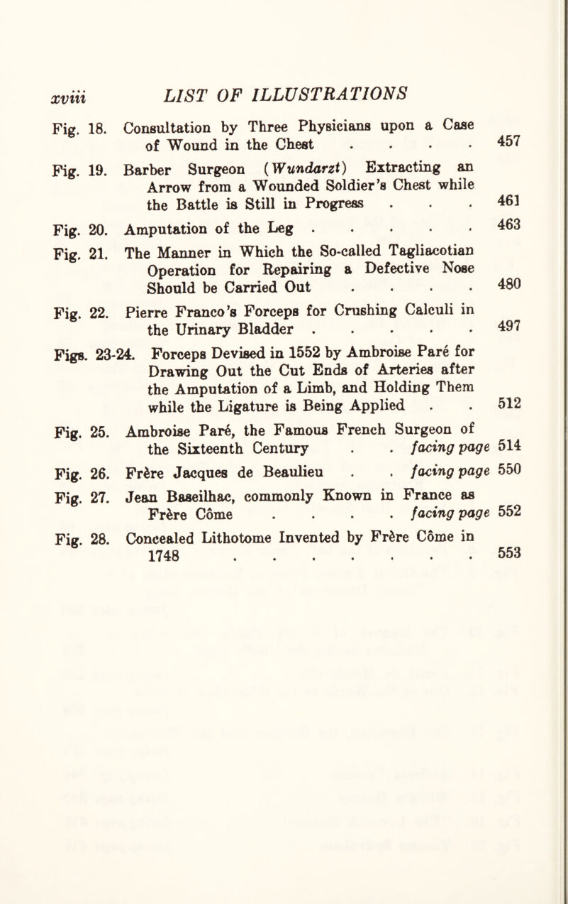 Fig. 18. Consultation by Three Physicians upon a Case of Wound in the Chest .... Fig. 19. Barber Surgeon (Wundarzt) Extracting an Arrow from a Wounded Soldier’s Chest while the Battle is Still in Progress Fig. 20. Amputation of the Leg ..... Fig. 21. The Manner in Which the So-called Tagliacotian Operation for Repairing a Defective Nose Should be Carried Out .... 457 461 463 480 Fig. 22. Pierre Franco’s Forceps for Crushing Calculi in the Urinary Bladder . . . . .497 Figs. 23-24. Forceps Devised in 1552 by Ambroise Pare for Drawing Out the Cut Ends of Arteries after the Amputation of a Limb, and Holding Them while the Ligature is Being Applied . . 512 Fig. 25. Ambroise Pare, the Famous French Surgeon of the Sixteenth Century . . facing page 514 Fig. 26. Fr£re Jacques de Beaulieu . . facing page 550 Fig. 27. Jean Baseilhac, commonly Known in France as Fr&re Come .... facing page 552 Fig. 28. Concealed Lithotome Invented by Fr£re Come in 1748 553
