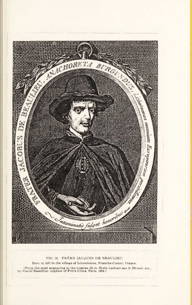 FKi. 26. FRIvKK JACQUES DE BEAULIEU, Born in J651 in the village of LtUendonne. Franehe-Comtc. Franco. (From the steel engraving in the treatise Da la Taii!e LatDala par It Mrinh\ etc., by Rascal Baseilhac, nephew of Fr&re Cftme, Baris, i$0».)