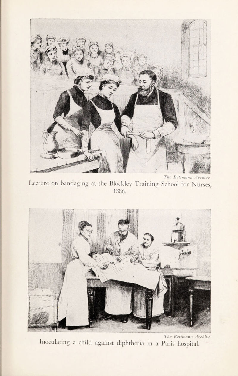 Lecture on bandaging at the Blockley Training School for Nurses, 1886. ' The Bettmann Archive Inoculating a child against diphtheria in a Paris hospital.