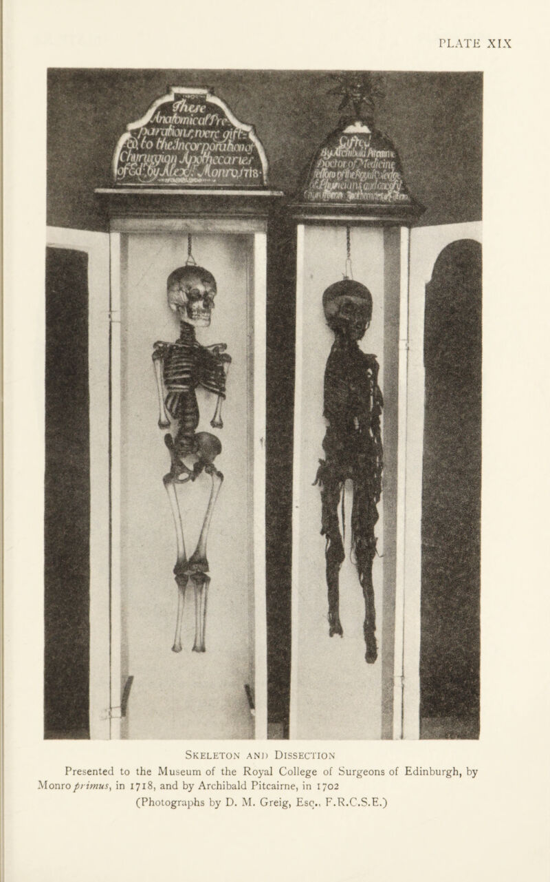 r/ ’(nafomicaffrftIla u^nfCT^W\ | | ornoruhnno? jyjthccarbdi * m. X'1’ AonrvAis A$m Skeleton anjj Dissection Presented to the Museum of the Royal College of Surgeons of Edinburgh, by Monro primus, in 1718, and by Archibald Pitcairne, in 1702 (Photographs by D. M. Greig, Esq., F.R.C.S.E.)