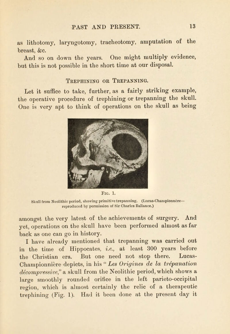 as lithotomy, laryngotomy, tracheotomy, amputation of the breast, &c. And so on down the years. One might multiply evidence, but this is not possible in the short time at our disposal. Trephining or Trepanning. Let it suffice to take, further, as a fairly striking example, the operative procedure of trephining or trepanning the skull. One is very apt to think of operations on the skull as being Fig. 1. Skull from Neolithic period, showing primitive trepanning. (Lucas-Championnere— reproduced by permission of Sir Charles Ballance.) amongst the very latest of the achievements of surgery. And yet, operations on the skull have been performed almost as far back as one can go in history. I have already mentioned that trepanning was carried out in the time of Hippocates, i.e., at least 300 years before the Christian era. But one need not stop there. Lucas- Championniere depicts, in his “ Les Origines cle la trepanation decompressive,” a skull from the Neolithic period, which shows a large smoothly rounded orifice in the left parieto-occipital region, which is almost certainly the relic of a therapeutic trephining (Fig. 1). Had it been done at the present day it