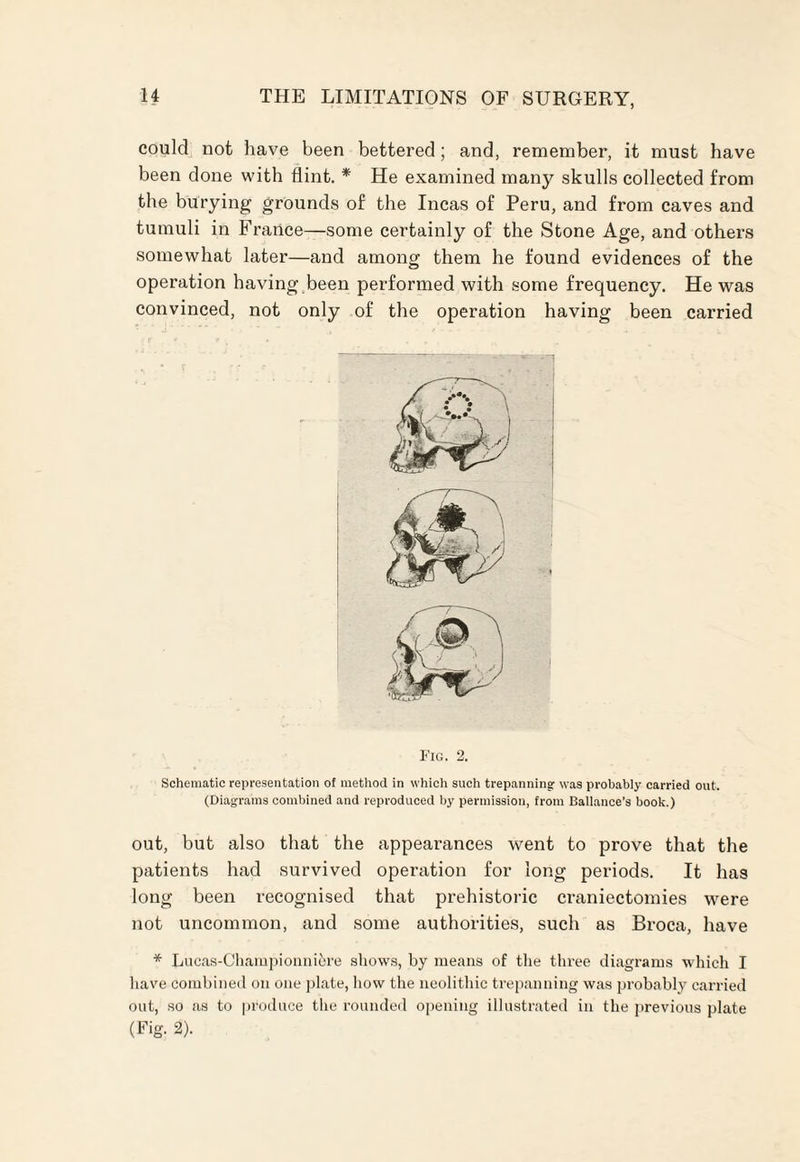 could not have been bettered; and, remember, it must have been done with flint. * He examined many skulls collected from the burying grounds of the Incas of Peru, and from caves and tumuli in France—some certainly of the Stone Age, and others somewhat later—and among them he found evidences of the operation having been performed with some frequency. He was convinced, not only of the operation having been carried Fig. 2. Schematic representation of method in which such trepanning was probably carried out. (Diagrams combined and reproduced by permission, from Ballance’s book.) out, but also that the appearances went to prove that the patients had survived operation for long periods. It has long been recognised that prehistoric craniectomies were not uncommon, and some authorities, such as Broca, have * Lucas-Champion nitre shows, by means of the three diagrams which I have combined on one plate, how the neolithic trepanning was probably carried out, so as to produce the rounded opening illustrated in the previous plate (Fig. 2).