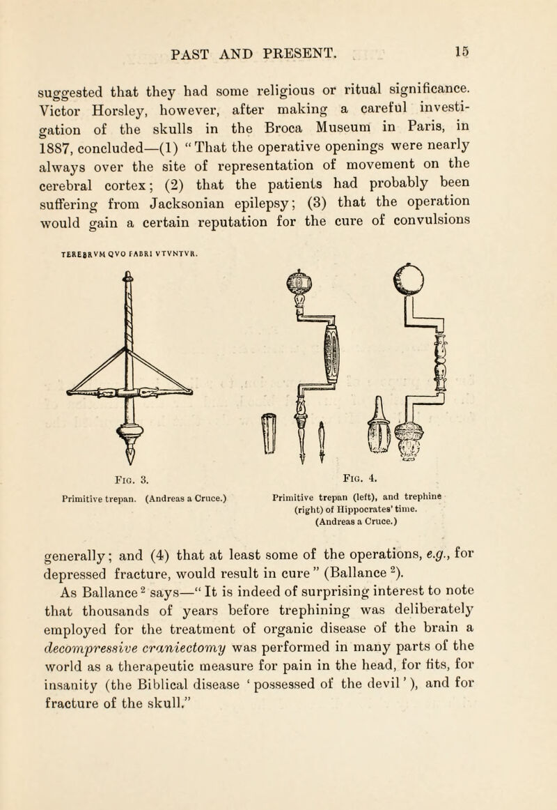 suggested that they had some religious or ritual significance. Victor Horsley, however, after making a careful investi¬ gation of the skulls in the Broca Museum in Paris, in 18S7, concluded—(1) “That the operative openings were nearly always over the site of representation of movement on the cerebral cortex; (2) that the patients had probably been suffering from Jacksonian epilepsy; (3) that the operation would gain a certain reputation for the cure of convulsions terebrvm qvo radri vtvntvr. Fig. 4. Primitive trepan (left), and trephine (right) of Hippocrates’ time. (Andreas a Cruce.) Fig. 3. Primitive trepan. (Andreas a Cruce.) generally; and (4) that at least some of the operations, e.g., for depressed fracture, would result in cure ” (Ballance 2). As Ballance2 says—“ It is indeed of surprising interest to note that thousands of years before trephining was deliberate^ employed for the treatment of organic disease of the brain a decompressive craniectomy was performed in many parts of the world as a therapeutic measure for pain in the head, for fits, for insanity (the Biblical disease 1 possessed of the devil ’), and for fracture of the skull.”