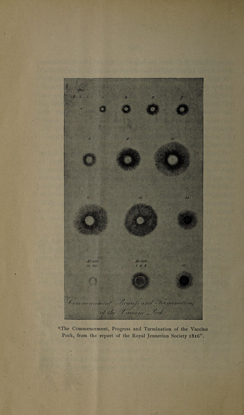 t “The Commencement, Progress and Termination of the Vaccine Pock, from the report of the Royal Jennerian Society i8l6”.