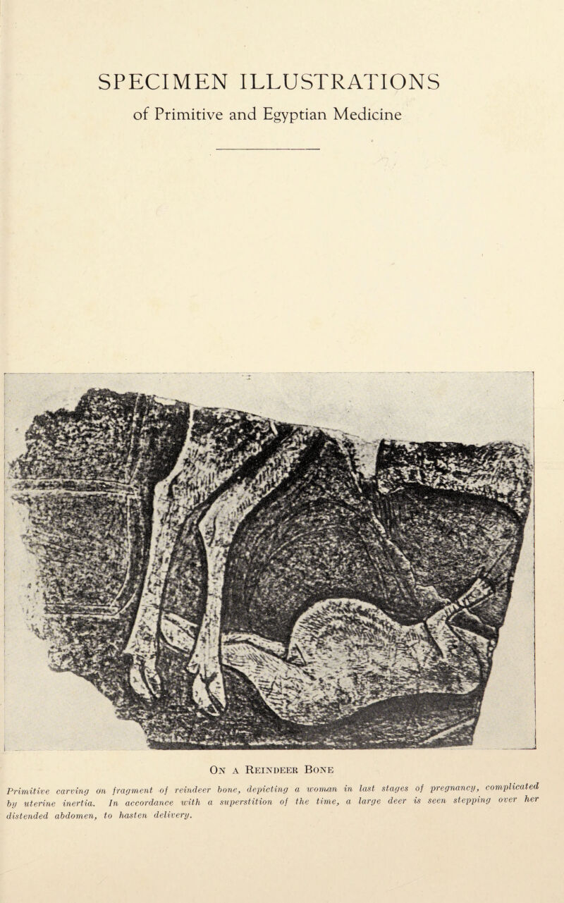 SPECIMEN ILLUSTRATIONS of Primitive and Egyptian Medicine On a Reindeer Bone Primitive carving on fragment of reindeer bone, depicting a woman in last stages of pregnancy, complicated by uterine inertia. In accordance with a superstition of the time, a large deer is seen stepping over her distended abdomen, to hasten delivery.