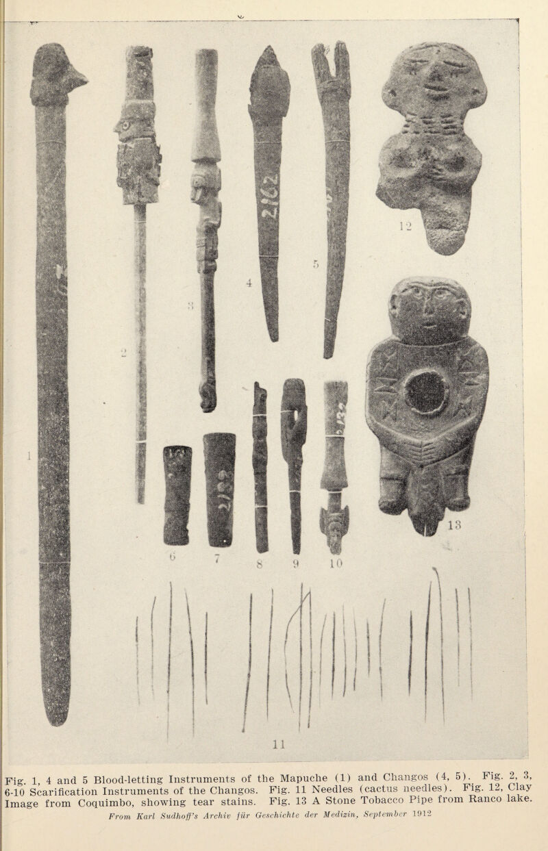 Fig. 1, 4 and 5 Blood-letting Instruments of the Mapuche (1) and Changos (4, 5).. Fig. 2, 3, 6-10 Scarification Instruments of the Changos. Fig. 11 Needles (cactus needles). Fig. 12, Clay Image from Coquimbo, showing tear stains. Fig. 13 A Stone Tobacco Pipe from Ranco lake. From Karl Sudhoff’s Archiv fur Geschichte der Medizin, September 1912