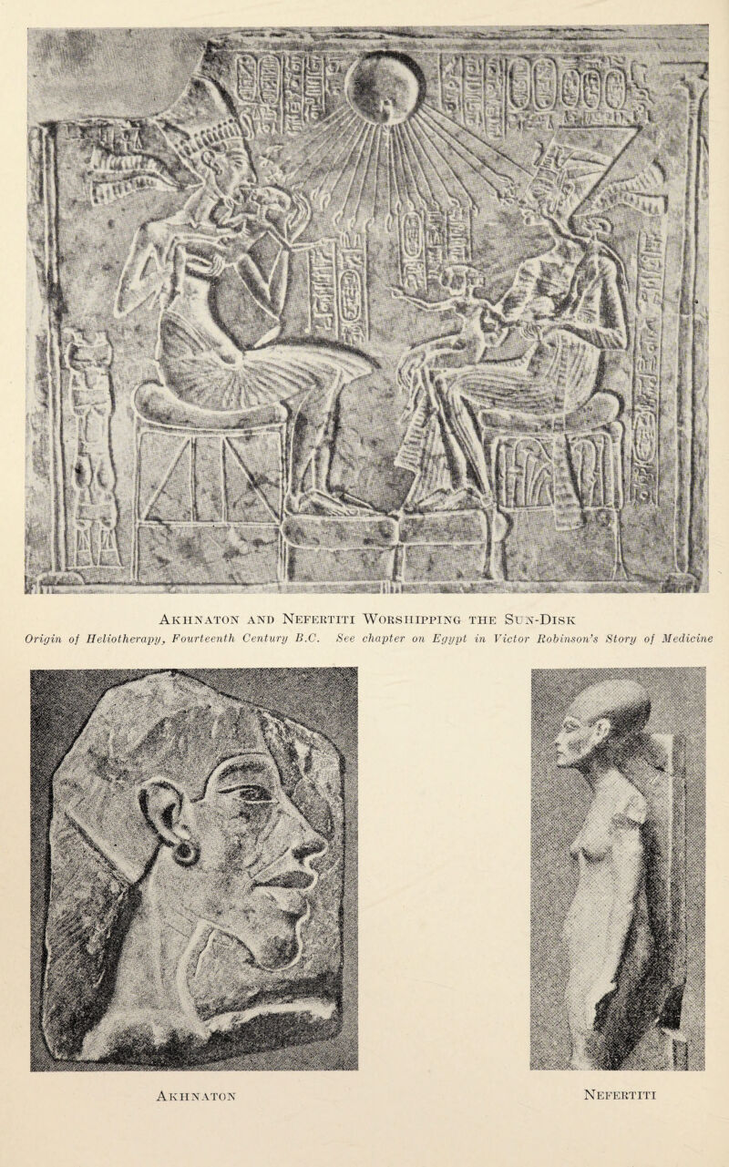 Akhnaton and Nefeetiti Worshipping the Sun-Disk Origin of Heliotherapy, Fourteenth Century B.C. See chapter on Egypt in Victor Robinson’s Story of Medicine Akhnaton Nefeetiti