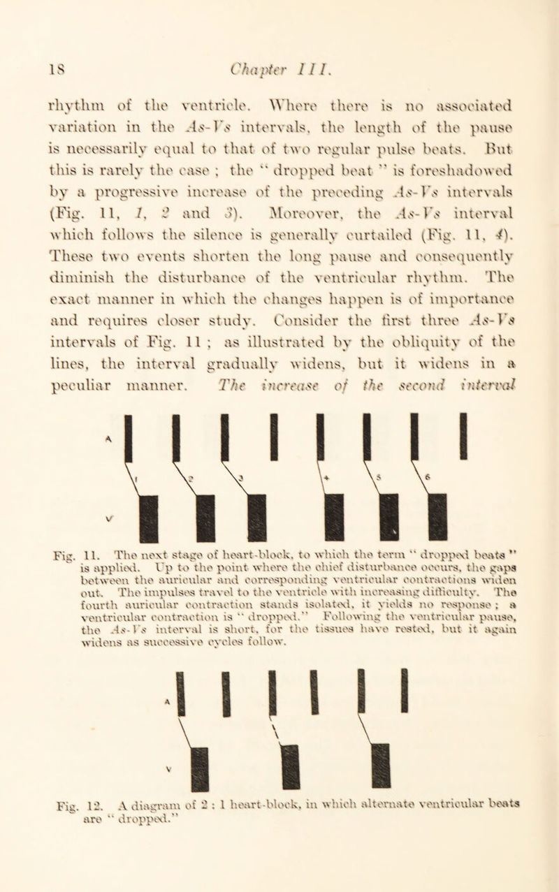 rhvthni of the veutriolo. Whoiv tlioro is no assooiatod variation in the .-Us'-lV intervals, the length of the pause is neeessarily equal to that of two regular pulse beats. Hut this is rarely the ease ; the “ dropped beat  is foreshadowed by a progressive inerease of the preeeding intervals (Fig. II, /. and 3). Moreover, the interval whieh follows the sileiiee is generally eurtailed These two events shorten the long pause and eonsequeiitly diminish the disturbanee of the ventrieular rhvthni. 'bhe exaet manner in whieh the ehanges happen is of imp^wtanee and requires eloser study. Consider the first three d.N'-Fs intervals of Fig. 11 ; as illustrated by the obliquity of the lines, the interval gradually widens, but it widens in a peeuliar manner. The iJicrea^^e of the ,<econd intervnl Fii:. ll. Tho i\oxt stage of htwrt-blook. to which tl\o term “ dropptxi Inwta ” is appUtxi. Up to the point whert' the ct\ief dist\irhai\oe ot.vui's. the gajva K'twtH''u the auricular and corrt'spending vei\tricular coxxtractions widen out. The impulst'>a travel to the ventricle with increasing dithculty. The foxirth aurictilar contraction stvands isolat<\l. it yields no ri'sponse ; a ventricular contraction is “ droppixi. Following the ventricular patise, the .4s-Us iixterval is short, for the tissues have resttxi. hut it again Nvidens as successive cycles follow. I I I I M \ I I 12. A diai^rain of 2 : 1 heart-block, in which alternate ventricular beitts are  dropptxl.