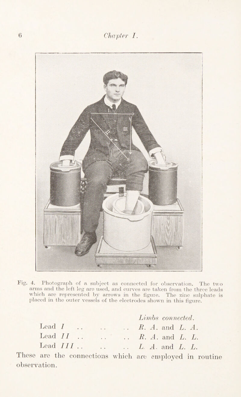 Fig. 4. Photograph of a subject as connected for observation. The two arms and the left leg are used, and curves are taken from the three leads which are represented by arrows in the figure. The zinc sulphate is placed in the outer vessels of the electrodes shown in this figure. Lead I Lead II.. Lead III.. These are the connections which observation. Limbs connected. B. A. and L. A. B. A. and L. L. L. A. and L. L. are employed in routine