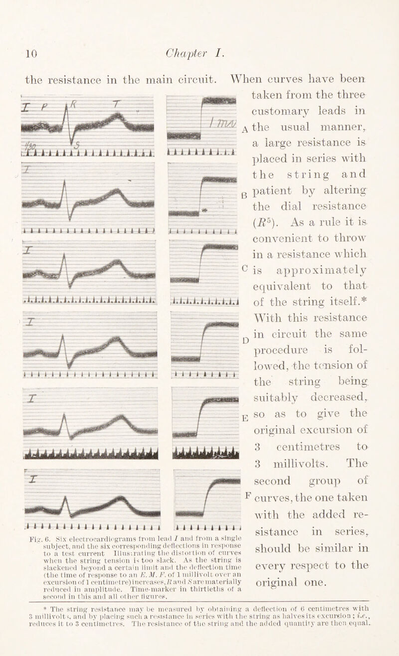 * The string resistance maybe measured by obtaining a deflection ot 6 centimetres with 3 millivolts, and by placing such a resistance in series witli the string as halves its excursion ; i.e., reduces it to 3 centimetres. The resistance of tlio string and the added quantity are then equals I;:fcAdEHfc:I:» h I the resistance in the main circuit. When curves have been taken from the three customary leads in A the usual manner, a large resistance is placed in series with the string and patient by altering the dial resistance (I?5). As a rule it is. convenient to throw in a resistance which is approximately equivalent to that of the string itself A With this resistance in circuit the same procedure is fol¬ lowed, the tension of jaEocw;eeoat11 atraa Fig. 6. Six electrocardiograms from lead I and from a single subject, and the six corresponding deflections in response to a test current Illustrating the distortion of curves when the string tension is too slack. As the string is slackened beyond a certain limit and the deflection time (the time of response to an E. M. F. of 1 millivolt over an excursion of 1 centimetre)increases,It and Sare materially reduced in amplitude. Time-marker in thirtieths of a second in this and all other figures. i i i i I ii i k ' . the string being suitably decreased r E so as to give the original excursion of 3 centimetres to 3 millivolts. The second group of F curves, the one taken with the added re¬ sistance in series, should he similar in every respect to the original one.