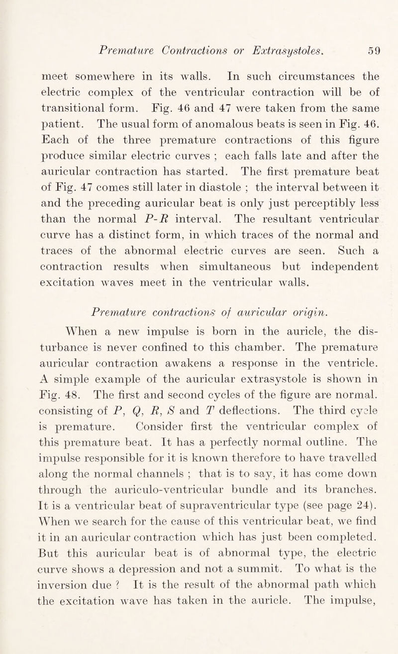 meet somewhere in its walls. In such circumstances the electric complex of the ventricular contraction will be of transitional form. Fig. 46 and 47 were taken from the same patient. The usual form of anomalous beats is seen in Fig. 46. Each of the three premature contractions of this figure produce similar electric curves ; each falls late and after the auricular contraction has started. The first premature beat of Fig. 47 comes still later in diastole ; the interval between it and the preceding auricular beat is only just perceptibly less than the normal P-R interval. The resultant ventricular curve has a distinct form, in which traces of the normal and traces of the abnormal electric curves are seen. Such a contraction results when simultaneous but independent excitation waves meet in the ventricular walls. Premature contractions of auricular origin. When a new impulse is born in the auricle, the dis¬ turbance is never confined to this chamber. The premature auricular contraction awakens a response in the ventricle. A simple example of the auricular extrasystole is shown in Fig. 48. The first and second cycles of the figure are normal, consisting of P, Q, R, S and T deflections. The third cycle is premature. Consider first the ventricular complex of this premature beat. It has a perfectly normal outline. The impulse responsible for it is known therefore to have travelled along the normal channels ; that is to say, it has come down through the auriculo-ventricular bundle and its branches. It is a ventricular beat of supraventricular type (see page 24). When we search for the cause of this ventricular beat, we find it in an auricular contraction which has just been completed. But this auricular beat is of abnormal type, the electric curve shows a depression and not a summit. To what is the inversion due ? It is the result of the abnormal path which the excitation wave has taken in the auricle. The impulse,