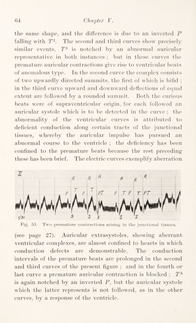 the same shape, and the difference is due to an inverted P falling with T2. The second and third curves show precisely similar events, T3 is notched by an abnormal auricular representative in both instances ; but in these curves the premature auricular contractions give rise to ventricular beats of anomalous type. In the second curve the complex consists of tAvo upwardly directed summits, the first of which is bifid ; in the third curve upward and dowmvard deflections of equal extent are followed by a rounded summit. Both the curious beats were of supraventricular origin, for each followed an auricular systole which is to be detected in the curve ; the abnormality of the ventricular curves is attributed to deficient conduction along certain tracts of the junctional tissues, whereby the auricular impulse has pursued an abnormal course to the ventricle ; the deficiencv has been confined to the premature beats because the rest preceding these has been brief. The electric curves exemplify aberration Fig. 55. Two premature contractions arising in the junctional tissues. (see page 27). Auricular extrasystoles, shotving aberrant ventricular complexes, are almost confined to hearts in Avhich conduction defects are demonstrable. The conduction intervals of the premature beats are prolonged in the second and third curves of the present figure ; and in the fourth or last curve a premature auricular contraction is blocked ; Ta is again notched by an inverted P, but the auricular systole which the latter represents is not folloAved, as in the other curves, by a response of the ventricle.
