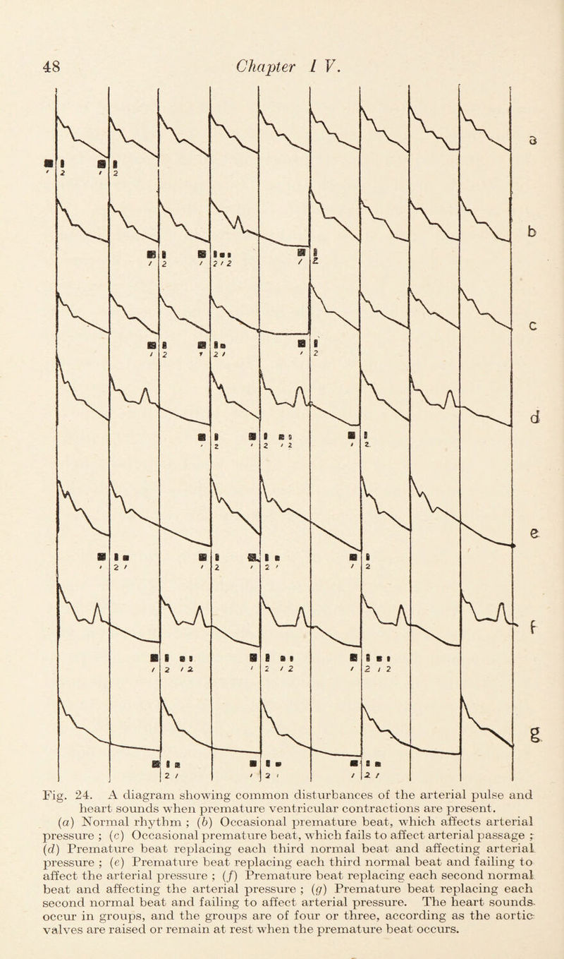 3 b c d 0 f g Fig. 24. A diagram showing common disturbances of the arterial pulse and heart sounds when premature ventricular contractions are present. (a) Normal rhythm ; (6) Occasional premature beat, which affects arterial pressure ; (c) Occasional premature beat, which fails to affect arterial passage ; (d) Premature beat replacing each third normal beat and affecting arterial pressure ; (e) Premature beat replacing each third normal beat and failing to affect the arterial pressure ; (/) Premature beat replacing each second normal beat and affecting the arterial pressure ; (g) Premature beat replacing each second normal beat and failing to affect arterial pressure. The heart sounds- occur in groups, and the groups are of four or three, according as the aortic valves are raised or remain at rest when the premature beat occurs.