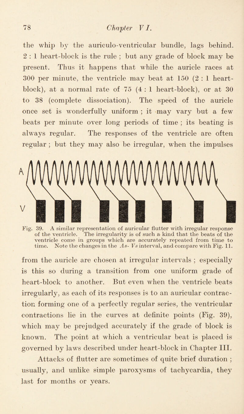 the whip by the auriculo-ventricular bundle, lags behind. 2 : 1 heart-block is the rule ; but any grade of block may be present. Thus it happens that while the auricle races at 300 per minute, the ventricle may beat at 150 (2 : 1 heart- block), at a normal rate of 75 (4:1 heart-block), or at 30 to 38 (complete dissociation). The speed of the auricle once set is wonderfully uniform ; it may vary but a few beats per minute over long periods of time ; its beating is always regular. The responses of the ventricle are often regular ; but they may also be irregular, when the impulses Fig. 39. x4 similar representation of auricular flutter with irregular response of the ventricle. The irregularity is of such a kind that the beats of the ventricle come in groups which are accurately repeated from time to time. Note the changes in the As- Vs interval, and compare with Fig. 11. from the auricle are chosen at irregular intervals ; especially is this so during a transition from one uniform grade of heart-block to another. But even when the ventricle beats irregularly, as each of its responses is to an auricular contrac¬ tion forming one of a perfectly regular series, the ventricular contractions lie in the curves at definite points (Fig. 39), which may be prejudged accurately if the grade of block is known. The point at which a ventricular beat is placed is governed by laws described under heart-block in Chapter III. Attacks of flutter are sometimes of quite brief duration ; usually, and unlike simple paroxysms of tachycardia, they last for months or years.