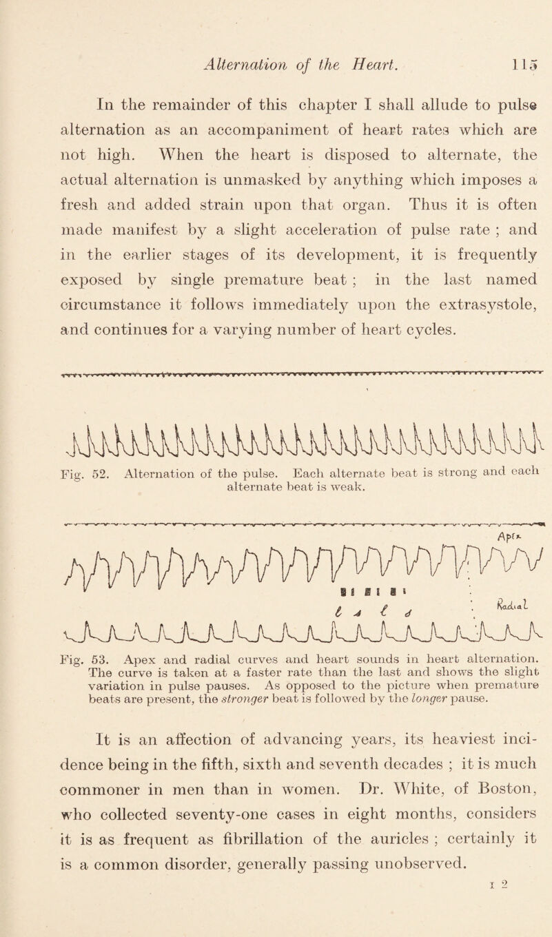 In the remainder of this chapter I shall allude to pulse alternation as an accompaniment of heart rates which are not high. When the heart is disposed to alternate, the actual alternation is unmasked by anything which imposes a fresh and added strain upon that organ. Thus it is often made manifest by a slight acceleration of pulse rate ; and in the earlier stages of its development, it is frequently exposed by single premature beat ; in the last named circumstance it follows immediately upon the extrasystole, and continues for a varying number of heart cycles. Fig. 52. Alternation of the pulse. Each alternate beat is strong and each alternate beat is weak. —v—v-y w ■ Radial ii II 1 I Fig. 53. Apex and radial curves and heart sounds in heart alternation. The curve is taken at a faster rate than the last and shows the slight variation in pulse pauses. As opposed to the picture when premature beats are present, the stronger beat is followed by the longer pause. It is an affection of advancing years, its heaviest inci¬ dence being in the fifth, sixth and seventh decades ; it is much commoner in men than in women. Dr. White, of Boston, who collected seventy-one cases in eight months, considers it is as frequent as fibrillation of the auricles ; certainly it is a common disorder, generally passing unobserved. T 9