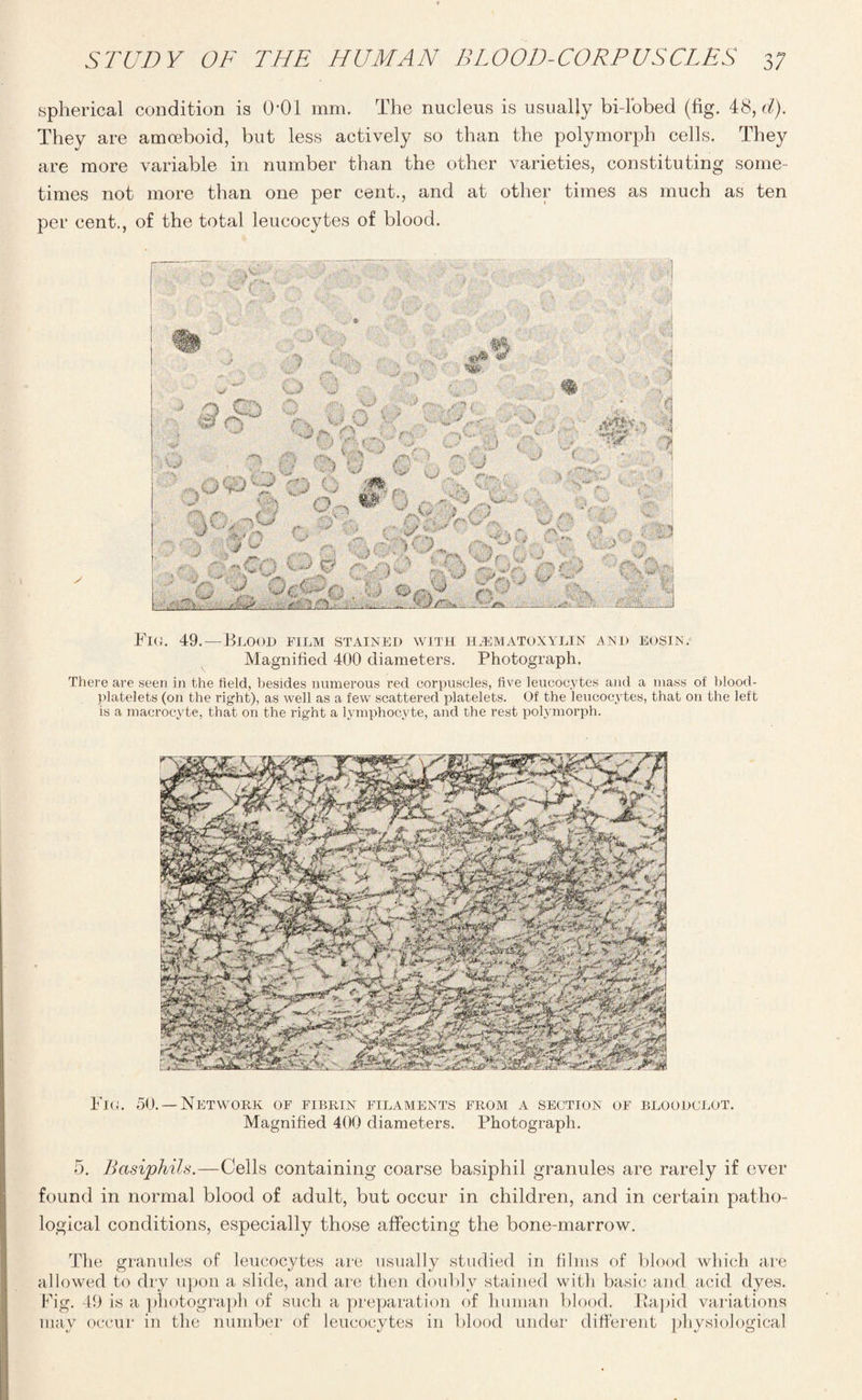 spherical condition is 0*01 mm. The nucleus is usually bi-l'obed (fig. 48, d). They are amoeboid, but less actively so than the polymorph cells. They are more variable in number than the other varieties, constituting some¬ times not more than one per cent., and at other times as much as ten per cent., of the total leucocytes of blood. Fig. 49.—Blood film stained with hematoxylin and eosin. Magnified 400 diameters. Photograph. There are seen in the held, besides numerous red corpuscles, five leucocytes and a mass of blood- platelets (on the right), as well as a few scattered platelets. Of the leucocytes, that on the left is a macrocyte, that on the right a lymphocyte, and the rest polymorph. Fig. 50. —Network of fibrin filaments from a section of bloodclot. Magnified 400 diameters. Photograph. 5. Basiphils.—Cells containing coarse basiphil granules are rarely if ever found in normal blood of adult, but occur in children, and in certain patho¬ logical conditions, especially those affecting the bone-marrow. The granules of leucocytes are usually studied in films of blood which are allowed to dry upon a slide, and are then doubly stained with basic and acid dyes. Fig. 49 is a photograph of such a preparation of human blood. Rapid variations may occur in the number of leucocytes in blood under different physiological