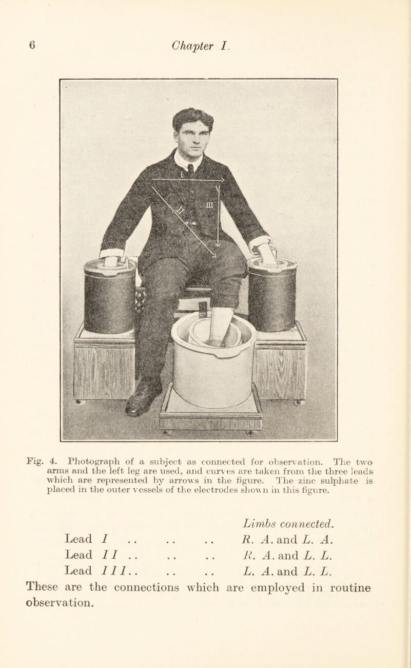 Fig. 4. Photograph of a subject as connected for observation. The two arms and the left leg are used, and curves are taken from the three leads, which are represented by arrows in the figure. The zinc sulphate is placed in the outer vessels of the electrodes shown in this figure. Lead I Lead II Lead III.. Limbs connected. R. A. and L. A. II. A. and L. L. L. A. and L. L. These are the connections which are employed in routine observation.