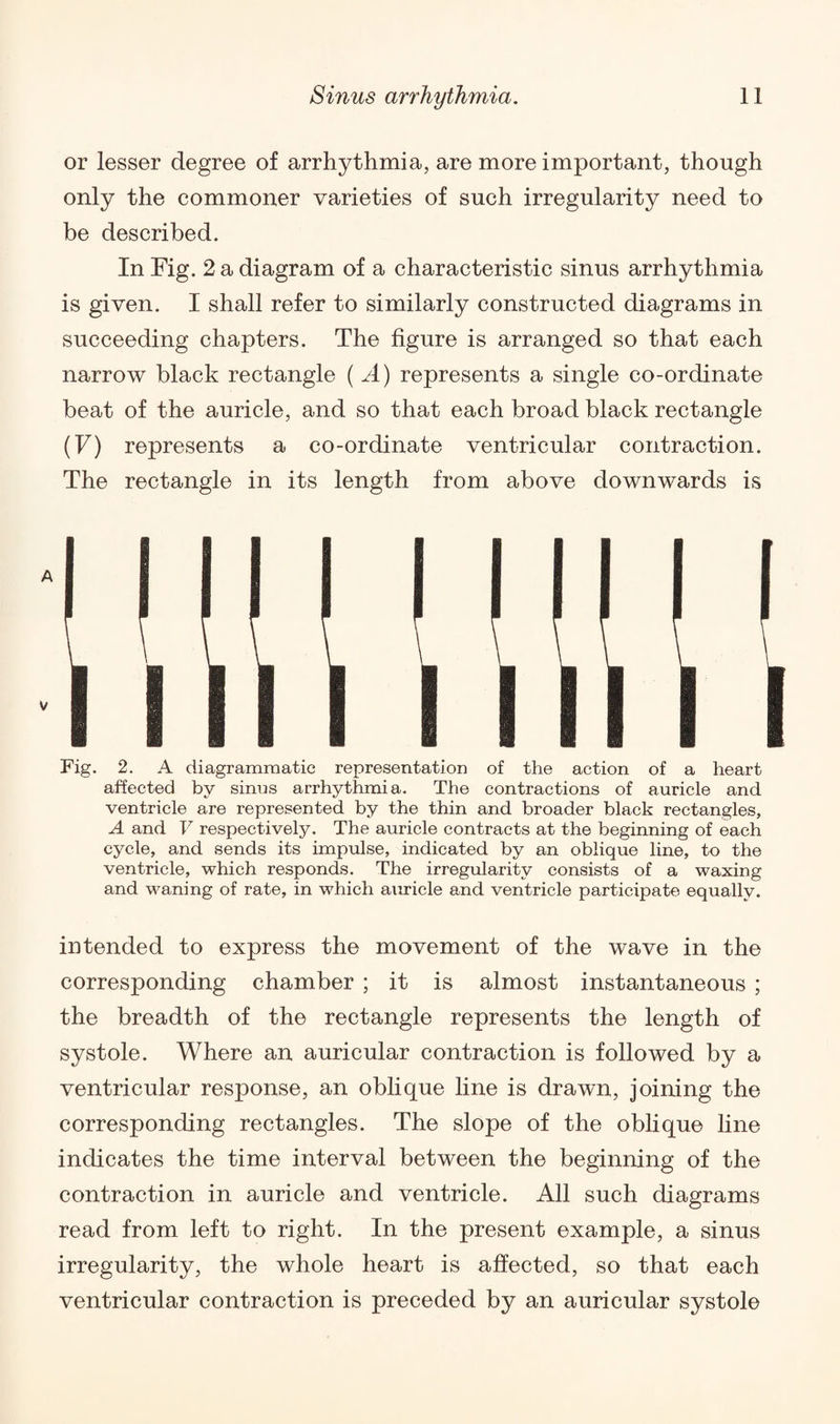 or lesser degree of arrhythmia, are more important, though only the commoner varieties of such irregularity need to be described. In Fig. 2 a diagram of a characteristic sinus arrhythmia is given. I shall refer to similarly constructed diagrams in succeeding chapters. The figure is arranged so that each narrow black rectangle ( A) represents a single co-ordinate beat of the auricle, and so that each broad black rectangle (F) represents a co-ordinate ventricular contraction. The rectangle in its length from above downwards is Fig. 2. A diagrammatic representation of the action of a heart affected by sinus arrhythmia. The contractions of auricle and ventricle are represented by the thin and broader black rectangles, A and V respectively. The auricle contracts at the beginning of each cycle, and sends its impulse, indicated by an oblique line, to the ventricle, which responds. The irregularity consists of a waxing and waning of rate, in which amide and ventricle participate equally. intended to express the movement of the wave in the corresponding chamber ; it is almost instantaneous ; the breadth of the rectangle represents the length of systole. Where an auricular contraction is followed by a ventricular response, an oblique line is drawn, joining the corresponding rectangles. The slope of the oblique line indicates the time interval between the beginning of the contraction in auricle and ventricle. All such diagrams read from left to right. In the present example, a sinus irregularity, the whole heart is affected, so that each ventricular contraction is preceded by an auricular systole