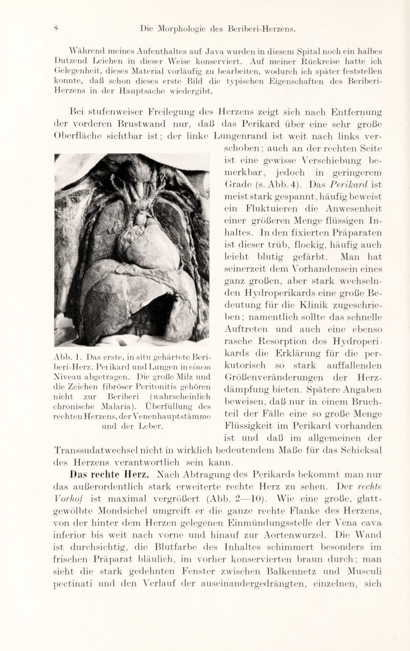 Während meines Aufenthaltes auf Java wurden in diesem Spital noch ein halbes Dutzend Leichen in dieser Weise konserviert. Auf meiner Rückreise hatte ich Gelegenheit, dieses Material vorläufig zu bearbeiten, wodurch ich später feststellen konnte, daß schon dieses erste Bild die typischen Eigenschaften des Beriberi- Herzens in der Hauptsache wiedergibt. Bei stufenweiser Freilegung des Herzens zeigt sich nach Entfernung der vorderen Brustwand nur, daß das Perikard über eine sehr große Oberfläche sichtbar ist; der linke Lungenrand ist weit nach links ver- _ schoben; auch an der rechten Seite ist eine gewisse Verschiebung be¬ merkbar, jedoch in geringerem Grade (s. Abb.4). Das Perikard ist meist stark gespannt, häufig beweist ein Fluktuieren die Anwesenheit einer größeren Menge flüssigen In¬ haltes. In den fixierten Präparaten ist dieser trüb, flockig, häufig auch leicht blutig gefärbt. Man hat seinerzeit dem Vorhandensein eines ganz großen, aber stark wechseln¬ den Hydroperikards eine große Be¬ deutung für die Klinik zugeschrie¬ ben; namentlich sollte das schnelle Auftreten und auch eine ebenso rasche Resorption des Hydroperi¬ kards die Erklärung für die per¬ kutorisch so stark auffallenden Größenveränderungen der Herz- dämpfung bieten. Spätere Angaben beweisen, daß nur in einem Bruch¬ teil der Fälle eine so große Menge Flüssigkeit im Perikard vorhanden ist und daß im allgemeinen der Transsudatwechsel nicht in wirklich bedeutendem Maße für das Schicksal des Herzens verantwortlich sein kann. Das rechte Herz. Nach Abtragung des Perikards bekommt man nur das außerordentlich stark erweiterte rechte Herz zu sehen. Der rechte Vorhof ist maximal vergrößert (Abb. 2—10). Wie eine große, glatt- gewölbte Mondsichel umgreift er die ganze rechte Flanke des Herzens, von der hinter dem Herzen gelegenen Einmündungsstelle der Vena cava inferior bis weit nach vorne und hinauf zur Aortenwurzel. Die Wand ist durchsichtig, die Blutfarbe des Inhaltes schimmert besonders im frischen Präparat bläulich, im vorher konservierten braun durch; man sieht die stark gedehnten Fenster zwischen Balkennetz und Musculi pectinati und den Verlauf der auseinandergedrängten, einzelnen, sich Abb. 1. Das erste, in situ gehärtete Beri- beri-Herz. Peiikard und Lungen in einem Niveau abgetragen. Die große Milz und die Zeichen fibröser Peritonitis gehören nicht zur Beriberi (wahrscheinlich chronische Malaria). Überfüllung des rechten Herzens, der Venenhauptstämme und der Leber.