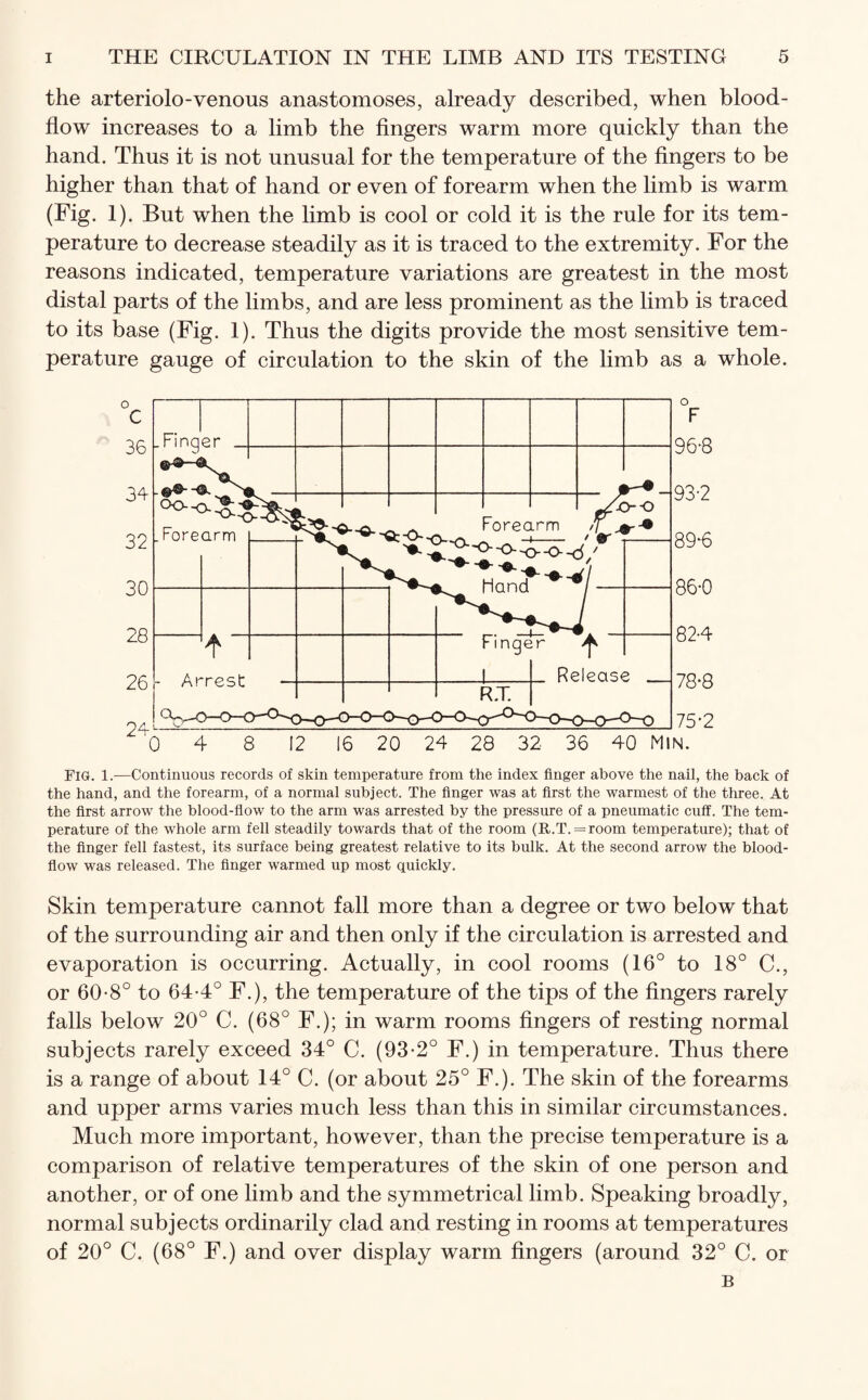 the arteriolo-venous anastomoses, already described, when blood- flow increases to a limb the fingers warm more quickly than the hand. Thus it is not unusual for the temperature of the fingers to be higher than that of hand or even of forearm when the limb is warm (Fig. 1). But when the limb is cool or cold it is the rule for its tem¬ perature to decrease steadily as it is traced to the extremity. For the reasons indicated, temperature variations are greatest in the most distal parts of the limbs, and are less prominent as the limb is traced to its base (Fig. 1). Thus the digits provide the most sensitive tem¬ perature gauge of circulation to the skin of the limb as a whole. Fig. 1.—Continuous records of skin temperature from the index finger above the nail, the back of the hand, and the forearm, of a normal subject. The finger was at first the warmest of the three. At the first arrow the blood-flow to the arm was arrested by the pressure of a pneumatic cuff. The tem¬ perature of the whole arm fell steadily towards that of the room (R..T.=room temperature); that of the finger fell fastest, its surface being greatest relative to its bulk. At the second arrow the blood- flow was released. The finger warmed up most quickly. Skin temperature cannot fall more than a degree or two below that of the surrounding air and then only if the circulation is arrested and evaporation is occurring. Actually, in cool rooms (16° to 18° C., or 60-8° to 64-4° F.), the temperature of the tips of the fingers rarely falls below 20° C. (68° F.); in warm rooms fingers of resting normal subjects rarely exceed 34° C. (93-2° F.) in temperature. Thus there is a range of about 14° C. (or about 25° F.). The skin of the forearms and upper arms varies much less than this in similar circumstances. Much more important, however, than the precise temperature is a comparison of relative temperatures of the skin of one person and another, or of one limb and the symmetrical limb. Speaking broadly, normal subjects ordinarily clad and resting in rooms at temperatures of 20° C. (68° F.) and over display warm fingers (around 32° C. or B