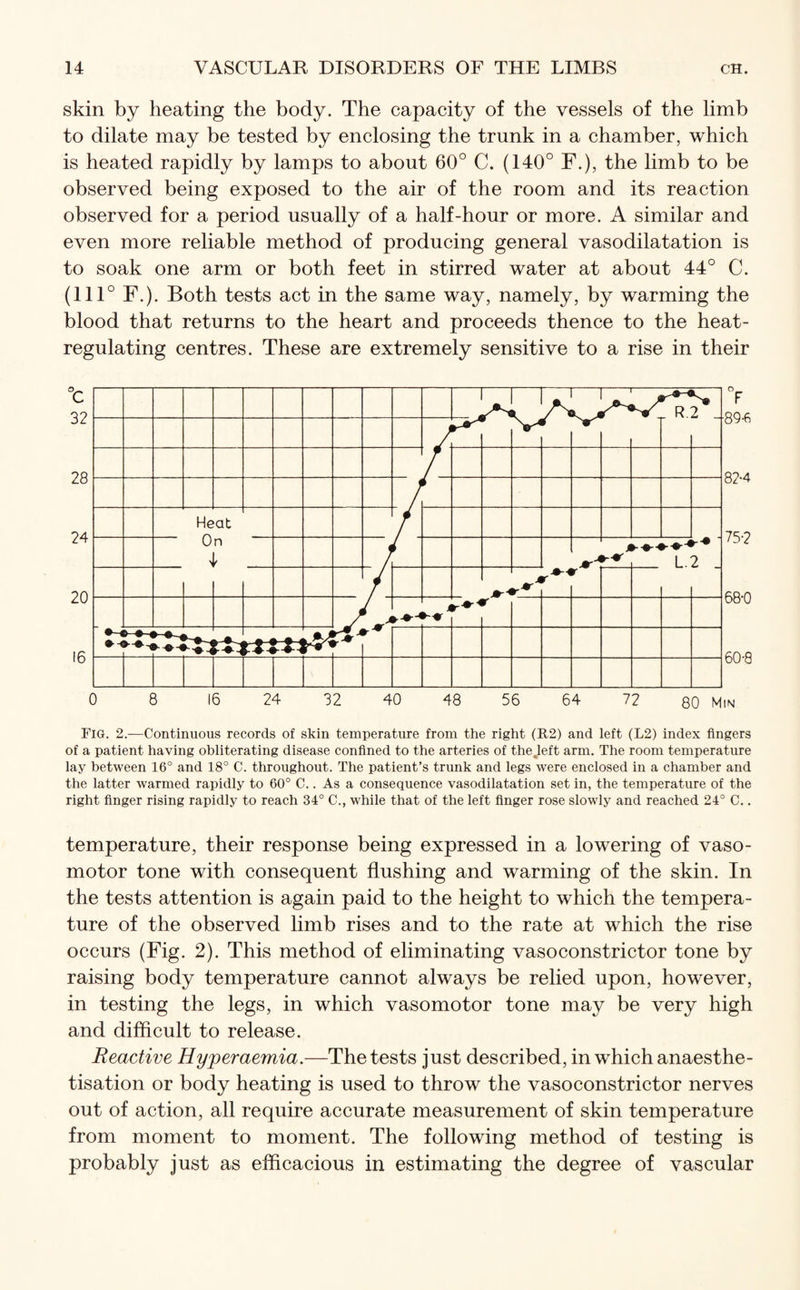 skin by heating the body. The capacity of the vessels of the limb to dilate may be tested by enclosing the trunk in a chamber, which is heated rapidly by lamps to about 60° C. (140° F.), the limb to be observed being exposed to the air of the room and its reaction observed for a period usually of a half-hour or more. A similar and even more reliable method of producing general vasodilatation is to soak one arm or both feet in stirred water at about 44° C. (111° F.). Both tests act in the same way, namely, by warming the blood that returns to the heart and proceeds thence to the heat¬ regulating centres. These are extremely sensitive to a rise in their Fig. 2.—Continuous records of skin temperature from the right (R2) and left (L2) index fingers of a patient having obliterating disease confined to the arteries of the .left arm. The room temperature lay between 16° and 18° C. throughout. The patient’s trunk and legs were enclosed in a chamber and the latter warmed rapidly to 60° C.. As a consequence vasodilatation set in, the temperature of the right finger rising rapidly to reach 34° C., while that of the left finger rose slowly and reached 24° C.. temperature, their response being expressed in a lowering of vaso¬ motor tone with consequent flushing and warming of the skin. In the tests attention is again paid to the height to which the tempera¬ ture of the observed limb rises and to the rate at which the rise occurs (Fig. 2). This method of eliminating vasoconstrictor tone by raising body temperature cannot always be relied upon, however, in testing the legs, in which vasomotor tone may be very high and difficult to release. Reactive Hyperaemia.—The tests just described, in which anaesthe- tisation or body heating is used to throw the vasoconstrictor nerves out of action, all require accurate measurement of skin temperature from moment to moment. The following method of testing is probably just as efficacious in estimating the degree of vascular