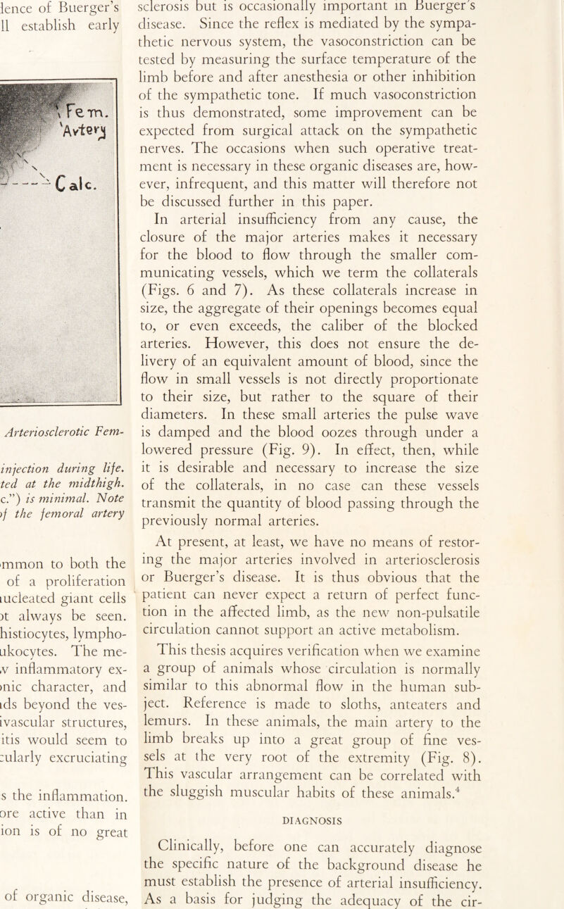 lence of Buerger’s 11 establish early Arteriosclerotic Fem- injection during life, ted at the midthigh. c.”) is minimal. Note )f the femoral artery mmon to both the of a proliferation Lucleated giant cells )t always be seen, histiocytes, lympho- ukocytes. The me- n inflammatory ex- >nic character, and ids beyond the ves- ivascular structures, itis would seem to :ularly excruciating s the inflammation, ore active than in ion is of no great of organic disease, sclerosis but is occasionally important in Buerger s disease. Since the reflex is mediated by the sympa¬ thetic nervous system, the vasoconstriction can be tested by measuring the surface temperature of the limb before and after anesthesia or other inhibition of the sympathetic tone. If much vasoconstriction is thus demonstrated, some improvement can be expected from surgical attack on the sympathetic nerves. The occasions when such operative treat¬ ment is necessary in these organic diseases are, how¬ ever, infrequent, and this matter will therefore not be discussed further in this paper. In arterial insufficiency from any cause, the closure of the major arteries makes it necessary for the blood to flow through the smaller com¬ municating vessels, which we term the collaterals (Figs. 6 and 7). As these collaterals increase in size, the aggregate of their openings becomes equal to, or even exceeds, the caliber of the blocked arteries. However, this does not ensure the de¬ livery of an equivalent amount of blood, since the flow in small vessels is not directly proportionate to their size, but rather to the square of their diameters. In these small arteries the pulse wave is damped and the blood oozes through under a lowered pressure (Fig. 9). In effect, then, while it is desirable and necessary to increase the size of the collaterals, in no case can these vessels transmit the quantity of blood passing through the previously normal arteries. At present, at least, we have no means of restor¬ ing the major arteries involved in arteriosclerosis or Buerger’s disease. It is thus obvious that the patient can never expect a return of perfect func¬ tion in the affected limb, as the new non-pulsatile circulation cannot support an active metabolism. This thesis acquires verification when we examine a group of animals whose circulation is normally similar to this abnormal flow in the human sub¬ ject. Reference is made to sloths, anteaters and lemurs. In these animals, the main artery to the limb breaks up into a great group of fine ves¬ sels at the very root of the extremity (Fig. 8). This vascular arrangement can be correlated with the sluggish muscular habits of these animals.4 DIAGNOSIS Clinically, before one can accurately diagnose the specific nature of the background disease he must establish the presence of arterial insufficiency. As a basis for judging the adequacy of the cir-