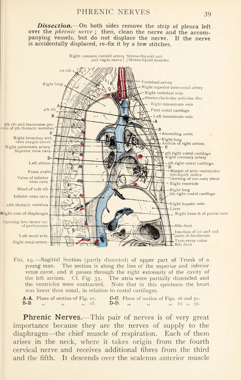 PHRENIC NERVES 39 Dissection.—On both sides remove the strip of pleura left over the phrenic nerve ; then, clean the nerve and the accom¬ panying vessels, but do not displace the nerve. If the nerve is accidentally displaced, re-fix it by a few stitches. Right common carotid artery Sterno-thyroid and and vagus nerve | | Sterno-hyoid muscles ist rib Right lung 5th rib and transverse pro- Right pulmonary artery Superior vena cava D Left atrium Fossa ovalis Valve of inferior vena cava Head of ioth rib Inferior vena cava nth thoracic vertebra Right crus of diaphragm j Opening into lesser sac of peritoneum Left renal vein - Right renal artery- Vertebral artery Right superior intercostal artery Right vertebral vein Sterno-clavicular articular disc Right innominate vein . First costal cartilage Left innominate vein -Ascending aorta ’Right lung Auricle of right atrium C 4th right costal cartilage Right coronary artery -5th right costal cartilage ’ D •—Margin of atrio-ventricular (tricuspid) orifice Opening of cor..nary sinus - Right ventricle - Right lung , 8th right costal cartilage Right hepatic vein Liver Right branch of portal vein — Bile duct Junction of rst and 2nd parts of duodenum Transverse colon Bile duct Fig. 19.—Sagittal Section (partly dissected) of upper part of Trunk of a young man. The section is along the line of the superior and inferior venae cavae, and it passes through the right extremity of the cavity of the left atrium. Cf. Fig. 35. The atria were partially distended and the ventricles were contracted. Note that in this specimen the heart was lower than usual, in relation to costal cartilages. A-A. Plane of section-of Fig. 27. C-C. Plane of section of Figs. 26 and 50. it 11 it 2^' D-D. ,, ,, ,, 25 ,, 55- Phrenic Nerves.—This pair of nerves is of very great importance because they are the nerves of supply to the diaphragm—the chief muscle of respiration. Each of them arises in the neck, where it takes origin from the fourth cervical nerve and receives additional fibres from the third and the fifth. It descends over the scalenus anterior muscle