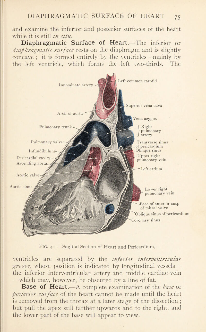 f, * DIAPHRAGMATIC SURFACE OF HEART 75 and examine the inferior and posterior surfaces of the heart while it is still in situ. Diaphragmatic Surface of Heart. The inferior or diaphragmatic surface rests on the diaphragm and is slightly concave ; it is formed entirely by the ventricles—mainly by the left ventricle, which forms the left two-thirds. The Innominate artery Left common carotid Arch of aorta1 Pulmonary trunk Pulmonary valv Infundibulum Pericardial cavity- Ascending aorta Aortic valve Aortic sinus Superior vena cava Vena azygos ) Right . pulmonary J artery Transverse sinus of pericardium Oblique sinus Upper right pulmonary vein Left atrium Lower right pulmonary vein Base of anterior cusp of mitral valve blique sinus of pericardium ''Coronary sinus Fig. 41.—Sagittal Section of Heart and Pericardium. ventricles are separated by the inferior interventricular groove, whose position is indicated by longitudinal vessels— the inferior interventricular artery and middle cardiac vein -—which may, however, be obscured by a line of fat. Base of Heart.—A complete examination of the base or posterior surface of the heart cannot be made until the heart is removed from the thorax at a later stage of the dissection ; but pull the apex still farther upwards and to the right, and the lower part of the base will appear to view.