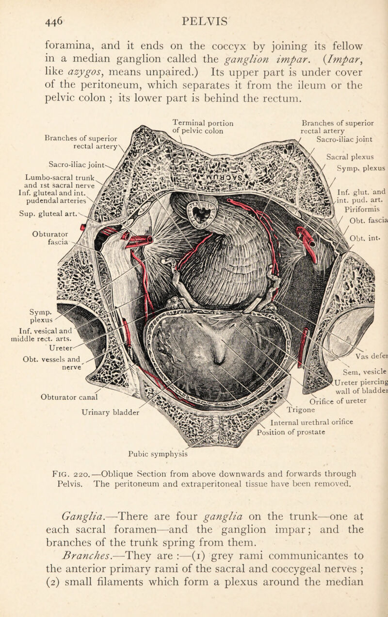 foramina, and it ends on the coccyx by joining its fellow in a median ganglion called the ganglion impar. (Impar, like azygos, means unpaired.) Its upper part is under cover of the peritoneum, which separates it from the ileum or the pelvic colon ; its lower part is behind the rectum. Terminal portion of pelvic colon Vas defer Sem, vesicle Ureter piercing wall of bladder Orifice of ureter Trigone Internal urethral orifice Position of prostate Branches of superior rectal artery Obturator fascia Inf. glut, and int. pud. art. Piriformis Obt. fascia Obt. int- Obturator canal Urinary bladder Sacro-iliac joint Lumbo-sacral trunk and ist sacral nerve Inf. gluteal and int. pudendal arteries Sup. gluteal art. Branches of superior rectal artery Sacro-iliac joint Sacral plexus Symp. plexus Symp. plexus Inf. vesical and middle rect. arts. Ure Obt. vessels and nerve Pubic symphysis Fig. 220.—Oblique Section from above downwards and forwards through Pelvis. The peritoneum and extraperitoneal tissue have been removed. Ganglia.—There are four ganglia on the trunk—one at each sacral foramen—and the ganglion impar; and the branches of the trunk spring from them. Branches.—They are :—(i) grey rami communicantes to the anterior primary rami of the sacral and coccygeal nerves ; (2) small filaments which form a plexus around the median