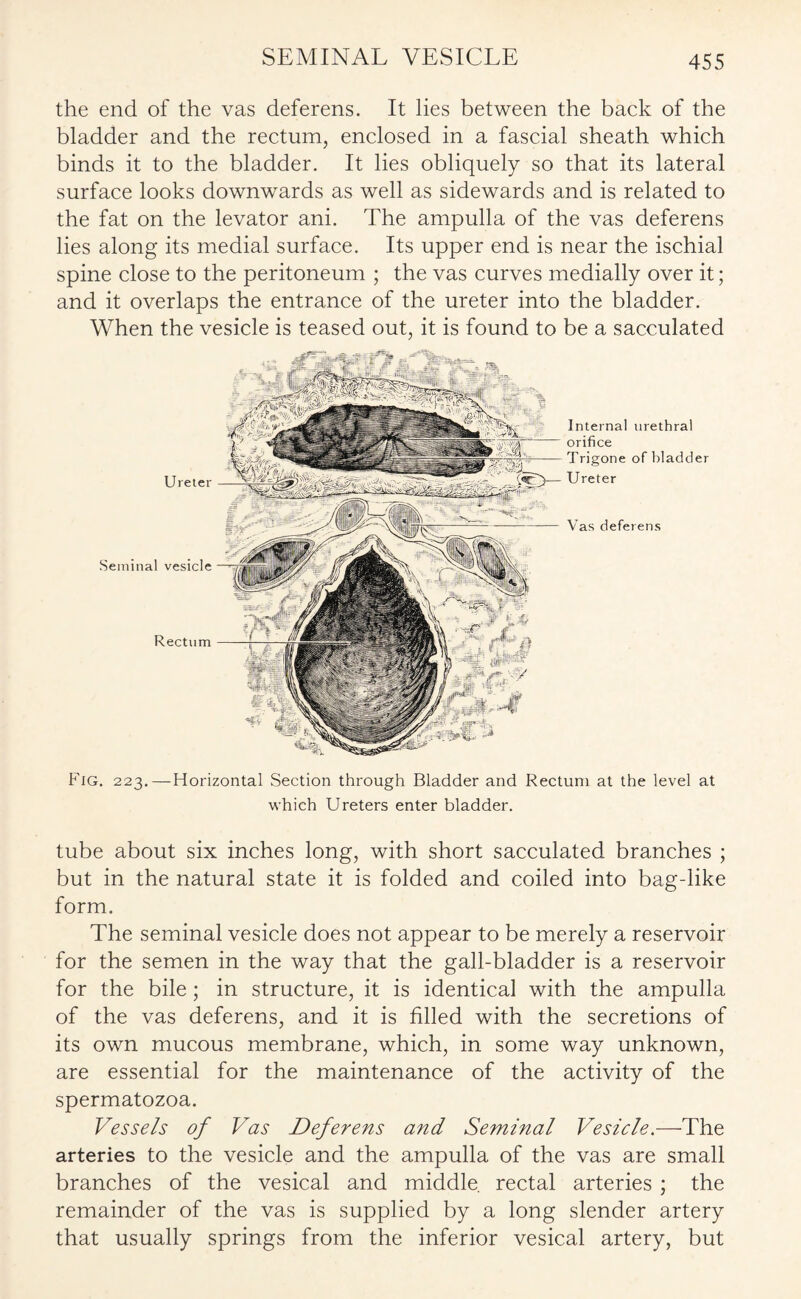 SEMINAL VESICLE the end of the vas deferens. It lies between the back of the bladder and the rectum, enclosed in a fascial sheath which binds it to the bladder. It lies obliquely so that its lateral surface looks downwards as well as sidewards and is related to the fat on the levator ani. The ampulla of the vas deferens lies along its medial surface. Its upper end is near the ischial spine close to the peritoneum ; the vas curves medially over it; and it overlaps the entrance of the ureter into the bladder. When the vesicle is teased out, it is found to be a sacculated Ureter Seminal vesicle Rectum Internal urethral orifice Trigone of bladder Ureter Vas deferens Fig. 223.—Horizontal Section through Bladder and Rectum at the level at which Ureters enter bladder. tube about six inches long, with short sacculated branches ; but in the natural state it is folded and coiled into bag-like form. The seminal vesicle does not appear to be merely a reservoir for the semen in the way that the gall-bladder is a reservoir for the bile; in structure, it is identical with the ampulla of the vas deferens, and it is filled with the secretions of its own mucous membrane, which, in some way unknown, are essential for the maintenance of the activity of the spermatozoa. Vessels of Vas Deferens and Seminal Vesicle.—The arteries to the vesicle and the ampulla of the vas are small branches of the vesical and middle rectal arteries ; the remainder of the vas is supplied by a long slender artery that usually springs from the inferior vesical artery, but