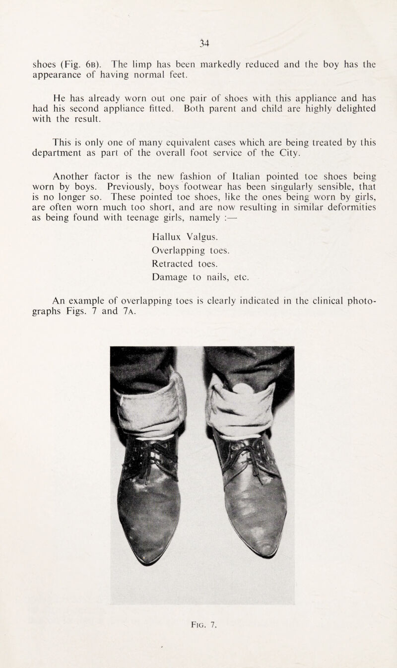shoes (Fig. 6b). The limp has been markedly reduced and the boy has the appearance of having normal feet. He has already worn out one pair of shoes with this appliance and has had his second appliance fitted. Both parent and child are highly delighted with the result. This is only one of many equivalent cases which are being treated by this department as part of the overall foot service of the City. Another factor is the new fashion of Italian pointed toe shoes being worn by boys. Previously, boys footwear has been singularly sensible, that is no longer so. These pointed toe shoes, like the ones being worn by girls, are often worn much too short, and are now resulting in similar deformities as being found with teenage girls, namely :— Hallux Valgus. Overlapping toes. Retracted toes. Damage to nails, etc. An example of overlapping toes is clearly indicated in the clinical photo¬ graphs Figs. 7 and 7a.