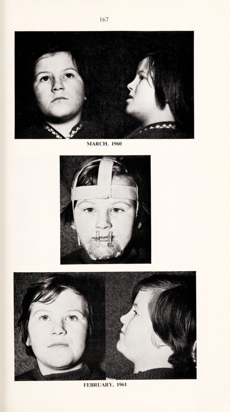 MARCH, 1960 FEBRUARY, 1961