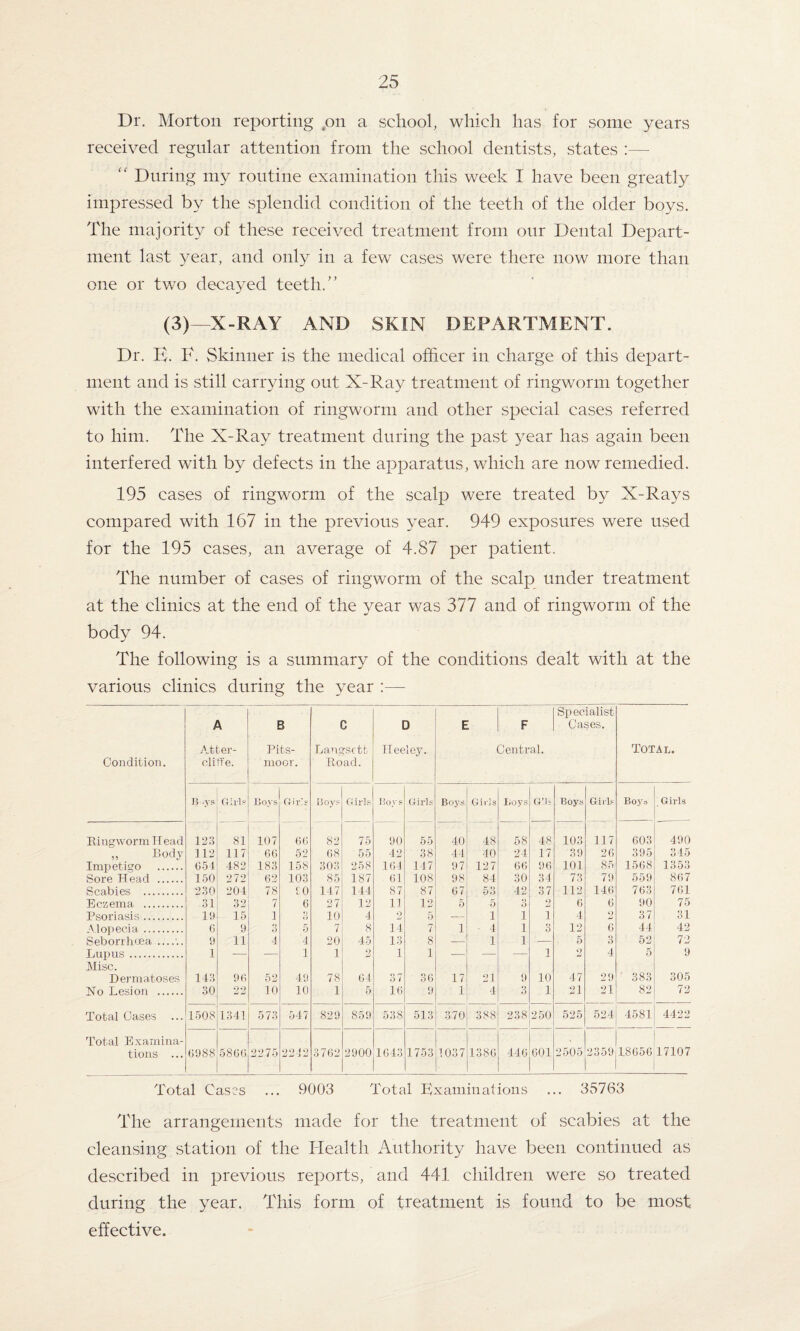 Dr. Morton reporting on a school, which has for some years received regular attention from the school dentists, states :— “ During my routine examination this week I have been greatly impressed by the splendid condition of the teeth of the older boys. The majority of these received treatment from our Dental Depart¬ ment last year, and only in a few eases were there now more than one or two decayed teeth.” (3)—X-RAY AND SKIN DEPARTMENT. Dr. E. F. Skinner is the medical officer in charge of this depart¬ ment and is still carrying out X-Ray treatment of ringworm together with the examination of ringworm and other special cases referred to him. The X-Ray treatment during the past year has again been interfered with by defects in the apparatus, which are now remedied. 195 cases of ringworm of the scalp were treated by X-Rays compared with 167 in the previous year. 949 exposures were used for the 195 cases, an average of 4.87 per patient. The number of cases of ringworm of the scalp under treatment at the clinics at the end of the year was 377 and of ringworm of the body 94. The following is a summary of the conditions dealt with at the various clinics during the year :— Condition. A Atter- cliffe. B Pits- moor. C Langsctl Road. D Heeley. E F Central. Specialist Cases. Total. B .vs Girls Boys (4 i r' s B oys Girls Hoys Girls Boys Girls Boys G’lt Boys Girls Boys Girls Ringworm Head 123 81 107 66 82 75 90 55 40 48 58 48 103 117 603 490 ,, Body 112 117 66 52 68 55 42 38 44 40 2 1 17 39 26 395 345 Impetigo . G54 482 183 158 303 258 164 147 97 127 66 96 101 85 1568 1353 Sore Head . 150 272 62 103 85 187 61 108 98 84 30 34 73 79 559 867 Scabies . 230 204 78 £0 147 144 87 87 67 53 42 37 112 146 763 761 Eczema . 31 32 7 6 27 12 11 12 5 5 3 2 6 6 90 75 Psoriasis. 19 15 i 3 10 4 2 5 — 1 i i 4 2 37 31 Alopecia. 6 9 9 O 5 7 8 14 7 1 4 i 3 12 6 44 42 Seborrhcea . 9 11 4 4 20 45 13 8 — 1 i — 5 3 52 72 Lupus . 1 — — 1 1 2 1 1 — — — 1 2 4 5 9 Misc. Dermatoses 143 96 52 49 78 64 37 36 17 21 9 10 47 29 383 305 No Lesion . 30 22 10 10 1 5 16 9 1 4 3 1 21 21 82 72 Total Cases ... 1508 1341 573 547 829 859 538 513 370 388 238 250 525 524 4581 4422 Total Examina¬ tions ... 6988 5866 2275 2242 3762 2900 1643 1753 1037 1386 446 601 2505 2359 J-1 CO 05 o> 17107 Total Cast's ... 9003 Total Examinations ... 35763 The arrangements made for the treatment of scabies at the cleansing station of the Health Authority have been continued as described in previous reports, and 441 children were so treated during the year. This form of treatment is found to be most effective.