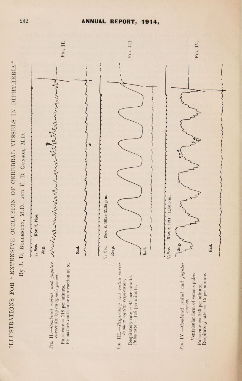 i—i a hH PH EH i-H 1—4 CH !—i a a co a a zn m rai h-h a a a a a a o a o a o I—I co s \—1 a o o o a > hH CO Szj a a a a a o a CO a O a <d a a CO a a a rH % O C/2 K & o no a Q £ a a rH H? O H cc H P O a a a a a $ ,1 o II > o !P -a £ c3 ^ C« C. a O <a> 03 f * Ph c3 a © Pu