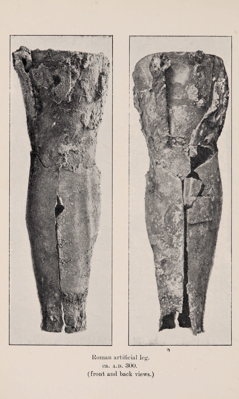 Roman artificial le^-. O ca. a.jo. 300. (front and back views.)