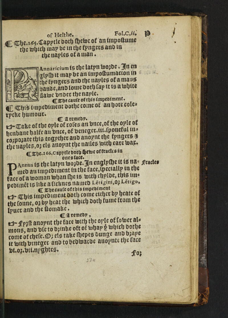 of Helthe. Fol.c.l'l'e gr ffibe.ns$*Capptleboth fl^ctoc of anfmpoftume t^e map be m t^c f|>ngces ano m the naples of a uian. Annancium fS the latpn toO?bC. Jtt Ctl alpftj it map be an tmpottumacion in the fpngets anb tfjc naples of a mans aanae.ano tome both fap tt is a tobtte aatoebnoettbenaple. / 1 aaUJE UHIW Ujsuaptv* -{C&ftecaufe of t!)i&impediment* §£ Chts tmpebiment bothc come of an t>otc cote* mite hutnouc. K Catcmctip. . , .. »5-Cafec of the ople of coles an bnce.of tfte ople of henbane halfe an bnce, of bcnegcc.ui.rponefalin- comojate this togpttjet anb anopnt the fpngecs a tbenaples.oj els anopnt the nailes totth eatetoa*. £r &hc,i 66,capptlc &otb ftctoc of fracles in onto face* P Annus is the latpn toojbejn englpfhe tt tsna-$mu$ meb an tmpebtment tn the face.lpectallp m the face of a toomatt to ban (he is totth chplbe, this tin* oebimet ts Itfce a ftebnes nameb Lea -im.ojJ-etigo* * C STlje caufc of t&is impediment cbis tinpetnment come cit^cc bp bsate ot ttj£ fotme, o? bp beat tbs tobteb &otb fame teom tbs fpueeanb tbs ftomabe* C a remedy, Kt-jfpjft anopnt tbs face toitb tbs opleofrobjccaU rnons, anb bfe to b?mbe oft of totjap p tohtth bothe come of chefe.®; els take Ihepcs bunge ant«b?a?e it totth imteget anb to bebtoatbe auopntc the face Dt.oj.hitmpghtcs. ^