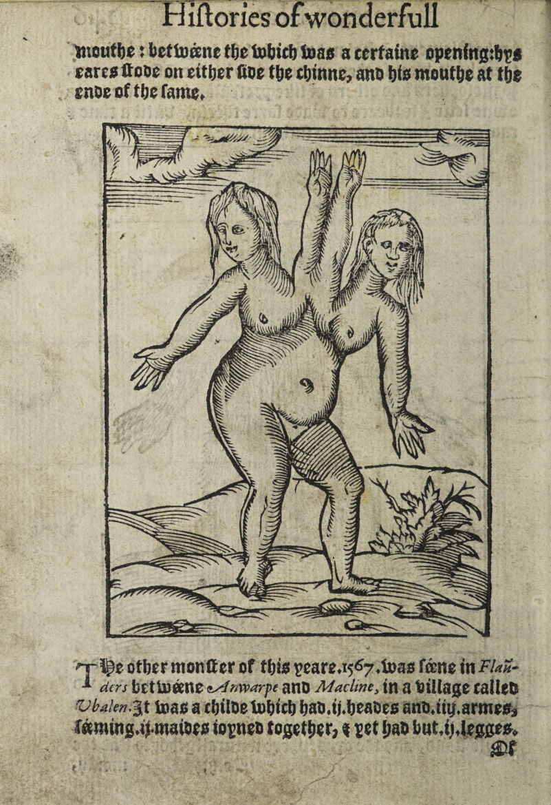 otber tnontter of this peare. 1567, boas fœne in FUU- •* dm bet ümne ^4marfe anD Maclme, in a Pillage cailetj vbalen.%t teas a cfjtlDe fobicb bao.ij.beatses antuiy.armesj .faming.tj.maioes io^neo together, t cet ijab but.ij,legges». Hiftories of wonderfull incutbe : bcttuccnc tbe fobitb teas a certaine opening:!)?* earcs ffooe on either Coe tbe cbinne, ant) bis moutbe at tbe enoe of tbe fame. t