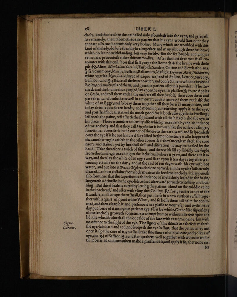 Signa. Curatio, (LIBER 1. and prieveth fo extremely, that it (eemeth tothe patient that his eyes ‘would ftart out : they appeare alfo moft commonly very bolne. Many which are troubled with this which do fee notwith{tanding but very feebly, Butthe feafonable applying of remedies, preventeth cither difcommodity. After this fort then you fhall en- counter with this euil. You fhal firft purge the ftomack & the braine with thefe $.{5.Scammony,Mirrhe,S affron,Balfamum,Mattick.Lignum Aloet, Olibanum, white Ag arick, Nux Judie,inyce of Liquorice,{eed of Apium, Lettuce,Succory, Bafilicon,ana.3 j Beateall thefe to powder,and confeé thern with the iuyceof Rofes,and make pilsofthem, and ginethe patient after his powder. Thefto- mack and the braine thus purged,lay vponthe eye this plaifter:Ry.foure Apples ot Crabs, and roft them ynder the embers till they be foft, then corethem and pare them, and brufe them well in a mortar; andto foure of them put halfe the white of an Egge,and fo bray them together till they be wellincorporate, and fo lay them vpon flaxen herds, and morniagand evening applyit tothe eye, and you fhal finde that it wil do much good;for it both aflwageth the (welling; lefleneth the paine, refrefheth the fight,and with all thefe fixeth allo the-eye in his place. Thereis another infirmity alfo which proceedeth by the abundance of melancholy,and that they callgula:for it is much likethe naile of afinger, fometime it breedeth in the corner of theeieto the eare-ward,and fo fpreadeth ouer the eye if it be not hindred & refifted betime:fometime it allo happeneth that another vngle arifeth in the other corner,& ifthey meet,it maketh the cure More vncertaine ; yet by heedfull skill and difcretion, it may be healed by the hand. Take therefore atwich of filuer, and therewith lift vp fubtilly the vngle from the tunicle, proceeding to the lachrimall where it orew,and there cut it a- way,and then lay the white of an egge and flaxe vpon itten dayes together,re- mouing it twife on the day , and at the end often dayes wath his eye with hot water, and put into it Pulwis Nabetus before named, till the eye be fufficiently cleared.Let him abftaine from fuch meatsas do feed melancholy.}t happencth alfo fomtime that the {uperfluous abundance of melicholy feated in the brains begetteth a drinefle in the eye-lids,which afterward turneth to itching and bur. ning. But this difeafe is cured by letting the patient bloud on thé middle veine in the forehead, and after with viing this Colliry: Ry. forty tender crops of the Bramble, and ftampe them {mall,then put them in a new earthen veflell toge- ther with a quart of goodwhite Wine , and {o boilethem till halfe be conir« med,and then cleanfe it and preferueitina glafle to your vfe, andtwife inthe day put fome of it into your patients eye; till it be whole.Of the like fuperfluity’ lid, the which bolneth all the one fide of the face with extreme paine, but with no offence tothe fightof the eye, The fignes of this difeafe are thefesit maketh the eye-lids bard and red,and keepeth the eyefo fhut, that the patient may not openit.Forthe cure of it,you fhall take fine foureof old wheate,and yolkes of egs,ana..j of Saffron,3.j.and ftampethem well together with womans milke till it be as au ointnaentsthen make a plaifter of it,and apply itfo, tharnone en- tee