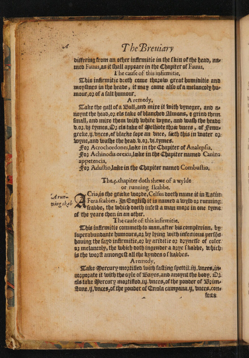 T heBremary differing krom an other infirmitie in the (kin of the head, nay med Fauus, as it ſhall appeare in the Chapiter of Fauus, Khe cauſe of this infirmitie. 8 This inkirmitie doeth came thoꝛow great humiditie and snoplines in the heade, it map come alſo ofa melancoly hu⸗ mour, oꝛ of a ſalt humour. A remedy, , Take the gall ot a Bull, and mixe it with vpneger, and a⸗ noynt the head, oz els take of blanched Almons, ¢ grind them ſmall, and mixe them with white wyne, and wach the heade d. oz. bj tymes.Oꝛ els fake of Melliote tha vnces, of enu⸗ greke. ij. vnces, of blacke ſope an vnce, feth this in water oz Wyne, and wache the head. v. oz. vj. tymes. Foꝛ Acrochordones, loke in the Chapiter of Analepſia. Foz Achinodis orexis, loke in the Chapiter named Canina. -appetencia, | 302 Aduſtio, lake in the Chapiter named Combuftio, The.g.chapiter doth shewe of a wylde or running {kabbe. epee Cris is the greeke woꝛde, Celſus doeth name it in Latin i CM Fra abies In CnglifH it is named a wyld 02 running ſcabbe, the which doeth inkeſt a man moze in one tyme of the peare then in an other. The caufe of this infirmitie, This infirmitie commeth to man, after his complerion, by ſuperabundante humours, oz by lying withinfedious perſõs hauing the ſapd infürmitie, oꝛ by ariditie oꝛ dꝛyneſſe of coler 92. melancoly, the which doth ingender a dꝛpe ſkabbe, which is the woꝛſt amongeſt all the kyndes o ſkabbes. Aremedy, Take Mercury moꝛtiſied with faſting ſpettil. it. vnces, in⸗ eoapozate it with the ople of Bapes, and anaynt the body. Oz els take Percury moꝛtiſiod.iij. vnces, oł the ponder of Bꝛim⸗ Tone. ij. vnces, ol the pouder of Ennla campana. i, n ging skab