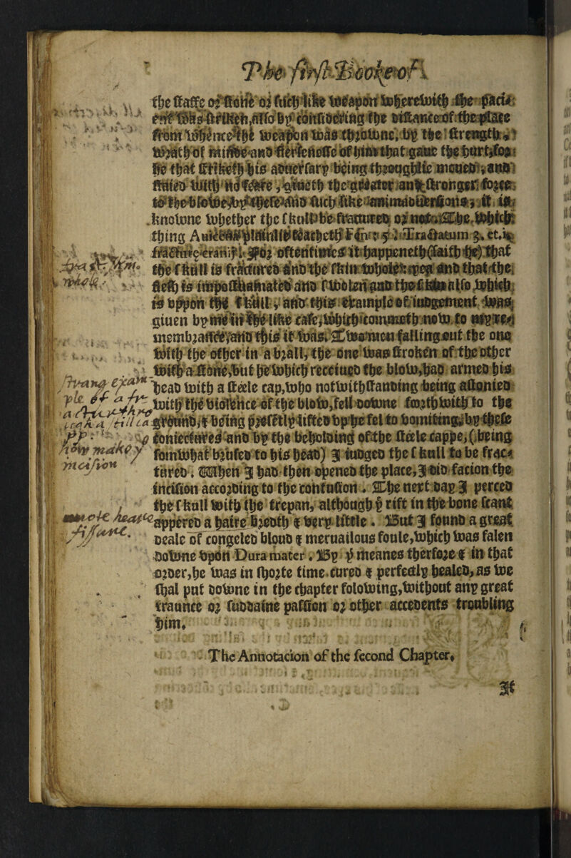 ?f - jr # > \ /V* w 4 IVVIwM V »7*v»r ¥»^w ■•■ w J ^ fie that eHfeeffifits actierfarpfiling tbtoqgblic meuebnauB's ffuieb toitb nci'f&re tfie'gfiiater an^ftroiipKfbj^ ..... —J— --—■• *- itiilb ** <1 u > . I1-* I /5Wi fiet)fe..„r—.—------- w b ppoh t$f Ifeiill r ahfr ffite ebainplcefcinbgement <bww, gtuen bpmelnf tfiiHf&e fafCjtofittfiitomBictl) note to mpte* membjart»VanD t^to tt toasi&to&wcMfallingout the one toith ttje other in abjaH,t|je one teas broken oftbeotber toifba iiotte.but betobicb receiucb tbe bloto,bao armeo tins X&yX~ ■ M *■'“ *“ — .'if. $ eoniecfnreo anti bp tbe befiotoing oftbe Crete tappe,( being . ... **?? fotntobaf bjufeb to bio be®) 3 tubs® tbe f ball to be frac* mcijvc* tareo.TObengbab then openeo tbe place,3bi&facion tbe incifion accoutringto tbecohtufion. SCfie nett oaj> 3 pertca tbe fftalt toitb tbe trepan, although t rift in the bone feant ^^^^appereo a fiairc bjeotfi « berp tittle. ®ut 3 fount) a great Cfa[C 0f congclcb blono f mernailous foule,tobicb bias falen Ootune bpon Dura mater, I3p p rneanes tberfoje f in that ojoer,he teas in Ifiojte time eureo * perfectlp bealeO,as toe fbai pat cotonc in the chapter folotoing,toithont anp great traunce o; fuDOatne paffion oj other acceoents troubling tjtm, i»!mrira aowifoi) Km! fffj Iff . • ■ * ? v» '4 .9 g>' ‘ * f fc % *'* . The Annotation of the fecond Chapter, *