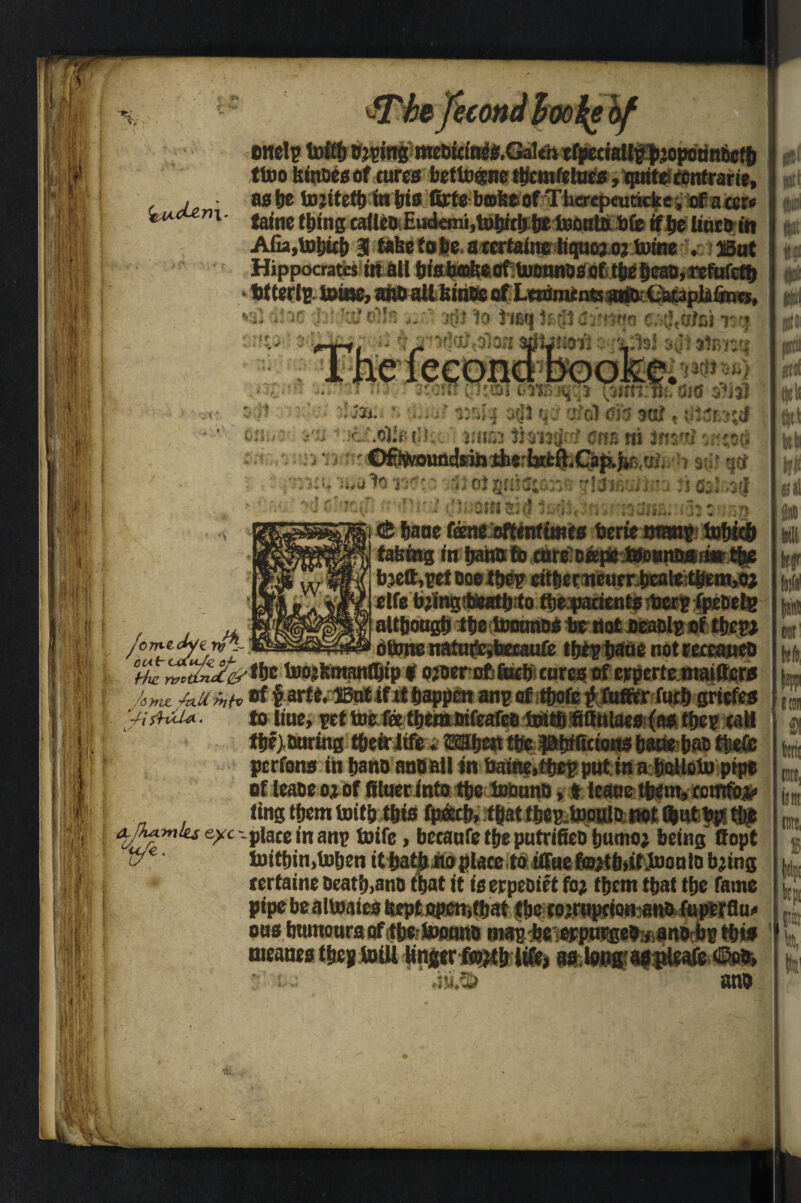 ttoo fetnoes of cures bettogne tbemfetaes, quite ccntrarie, , • as be tojitetb in bis Crte bcDkeof Therepeuticke. ofacerc laine thing calico Eutkmi.tobtcb be iBoutu bfe if be liuco in Afia,tobitb 3 tabe to be a ccrtaine liquoj o? toine . jiut Hippocrates in ail bis bake oftoonnos of tbe beao, rcfufctb • ttterlE mine, ano all bmoc of LtrOmentsatfO Catapiafines, • hiksl oils #3 agt 1» irntj 5s til C:' J,tsIsnoq MW rfi. r : iAeiecond bookei^dJ^} *i ft t >? JJi * ( -f ** *> r~ ,* V v 1 i : * 4 iii :■ ^ 0 4 2 ^J- ' Jt/Aii wt dJCf $?j$) on. : »r jOrr^ady^ rfe- ' oufrcaWzoJ- il !f • Me Yvotxnctc/ ru rh: tjtm ¥m$dai nm m imtf : i Tj. uiirsrl- yti ftjlpttOlO V;*- G O) 8flhftC;.v-‘. U 03lr4(f MMM j: oin si(5 af'HdiiB. »33 z'^3 <t fmne (knt oftentimes tern wm&ixU(b fairing m cattmpc l#o*nDmi»tfee b:eft,ret 000 Vm ctffjcruEuerbcaieitgem^oj clfe bjing’t&at&ito tbe^arients ticr^ fpmtg d&ms natufebeeauft tfjeptjaud notreemteo [ L fhe rvoidnet„ _ Umjt Mtappmmgtiitbafc r furf> grit fes wv r U ishiU. to liue, ret toe fee tbera oifeafee totfb fifiulacs (as fijes call He tilt) curing t&eir life. Mben tbe Pbtficionsbaue baefijefe perrons in bano ano all in baine,tfcep pnt in a bolloto pipe of lease oj Of filuecinfo tbe toouno, i leauetbem,cowfo*< ting tbem toitb tbia fpeecb, that tbcp.tooulo not (but bp the a^fUwiu eye -place in anp toife, becaufe tbe putrifieo fjumoi being ttopt ue toitbin.toben it tjatfj no place to iffue frajti),it too u lo bjing ccrtaine Deatb>ano that it is erpeoirt fo; tbem that tbe fame pipebealtoaies Sept open,that tbe cojrnpctonanofBperflux ous humours oftbetoonno mas-ArtWpurgeb/ianb b® this tneanes fb«s toill Hngtrfwjt&life, aslonff aspteafe <2ob» • t.; ,isi,3) ' ano Hit 11 in nit