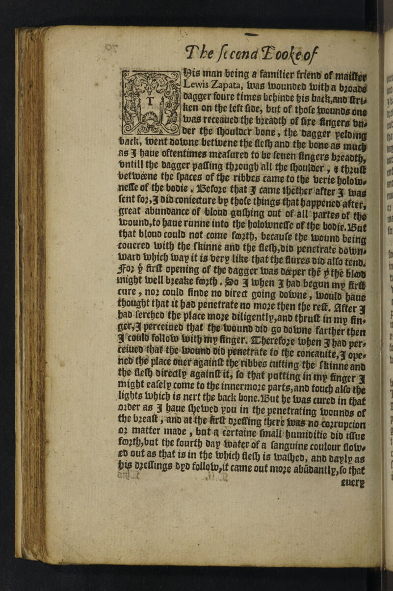 T he ft con a 2?co,{e of l$ie titan being a fatmiier frteno of maiffer Lewis Zapata, teas InounoeD teitba bjoate Dagger foure times bc&inoe bis batfe,ann Bri* ben on tfjc left fine, but of tbofe luotitiDs one teas receaucD tije bieaottt of fire fingers bn* Der ttje Iboutoer bone, tije bagger retotna barb, toenfnotone beftoene tbe flelb ano ftjc bone as ntneb as 3 baue oftentimes meatmen to be feuen fingers bjeaotb tmtitl tbe Dagger pairing though all tbe fl&oulDer, $ tfoutf bettoeene tbe rpates of tbe ribbes came to tbe berie boloto# neffe of tbe bonie. USefoje that 3 tame tbetber after 3 tras tent foj,3 nin ronietture bp tbofe things thatbappenen after, great abonnance of tionn gntbing out of all partes of tbe tcounn,to baue rnnne into tbe boloUmetfe of tbe bonie.lSuf tfiat blouo eouln not tome fmjfb, becaufe tbe toounn beina toucreo toitb tbe fbinne ann tbe flc(b,Din penetrate noton, Warn tobieb toap if is berp litre that tbe flutes nin alto teno. iroj p ftrff opening of tbe nagger teas Deeper the * tbe bimn snigbt toell bteahe fmjtlj. S’o 3 icljcn 3 ban begun mp firffi cure, noi eouln finne no Direct going Dotone, toouln baue thought that tt ban penetrate no moje then tbe reft, after 3 ban fertben the plate moje niligentlp,ann tbrnft in mp fin, ger,| perceiuen that tbe foounn Din gonotnne farther then 3 eouln foltoto tottb mp finger. SDbcrefoae toben 3 ban per, tetnen ttjaf tbe toounn nin penetrate to tbe concauife,3 oue, nen tbe plate Dueragaintt tbe ribbes cuffing tbe fitimteano tbe flelb mrertlp againtt it, fo that putting in mp finger 3 mtgbt cafeip tome fo tbe innermo’e parts,ann foneb alfo tbe lights inbtcb ts nerf the back bone,3iBut be teas cured in that oper as 3 baue tyetood pou in tbe penetrating foounds of tbe b^eaft, and at tbe ftrtt Duelling there teas no abruption o: patter made, but a cerfaine fmall bumiditie Dio ilTue f©jtb,but tbe fourth &ap foaferofa fanguinecculcurfiofo# out as that is in the fobicb flelb is teamed, and aaplp as ®is Dwellings dpo folloto,it came out mo;e abudantlp,fo that ^ * euerg