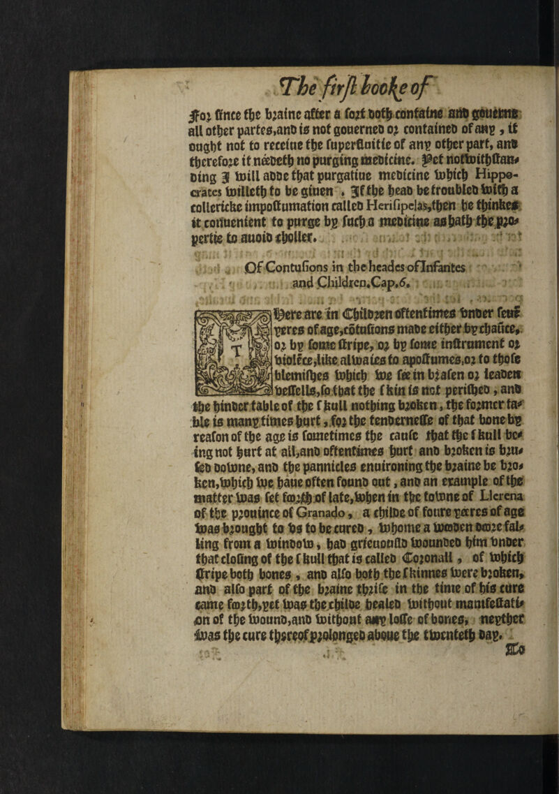 $a% Cnee the bjainc after a fo?f oofbeonfaine ant) goutrne all better partes,ano is not goaerneo oj containeo of a«p, if ought not to reccttie the fuperffuitie of anp other part, an# therefore itneceth no purging meoieme. pet nottoitljttaiw Ding B! toil! aooc that purgatiue meoicine tohich Hippo¬ crates toillctt) to beginen . 3fthe heao be trouble# toifh a collcrithc impoffumation calico Herifipe|as,then he ttjinhcs it coiiuenient to purge bp fact) a meoieme as hath thepjo* pertie to auoio choller. .. ’ * .u f V » » « v>, < «•* ( ft # ( ' ( 1 I i 4 t * ' ’ ' * ' - : i 'ft .•* v ( C s 4 4 •’ t » ‘ * ,Of Contulions in the heades oflnftntes and Cliildrcn.Cap.6. s^jl^ereare in Chilojen oftentimes bnoer fetre peres of age,cotufions ntaoe either bp chauce, oi bp fornc ttripc, oj bp tome inttrmnent oj biolece.ltlte altoatesto apoffumes.oj to thofe blemtlbes tohich toe feeinbjafen oj ieaoett __lbeffeHs,fo that the fhin is not periibeo, an# the hinocr table of the f hull nothing bjohen, the former fa* ble is manp times hurt, fo’the tenoerneffe of that bone bp reafonofthe age is fometimes the cauic that the! hull be* ing not hurt at all,anO oftentimes hart ano bjohen is bju* too ootone, ano the pannicles enuironing the bjainc be bjo< hen,tohich toe haue often founo out, ano an erample of the matter toas fet faj’th of late.tohen in the totone of Llerena of the pjouince of Granado, a cthloe of fotire pares of age toas brought to Us to be cureo, tohome a toooen eoje fal* ting from a toinooto, hao gricuonflo toounoeo him bnocr that doling of the f hull that is calleo Cojonali, of tohich firipe both bones, ano alfo both the fhinnes toere bjohen, ano alfo part of the bjaine tb?ifc in the time of his cure came fa>jtb,pet toas the.chiloe bealeo toithout mantfettati# an of the toouno,ano toithout anp Ioffe of bones, neptber toas the cure t hereof pjolongeoaboue the ttoenteth bap. • •;; ICO
