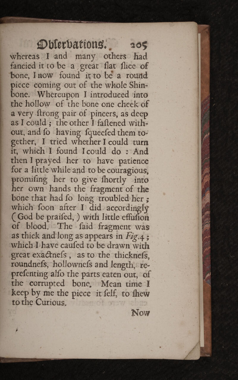 €)br0ct)at 1 oiis*, 2 05 whereas I and many others had fancied it to be a , great flat flice of bone, I now found it to be a round piece coming out of the whole Shin¬ bone. Whereupon I introduced into the hollow of the bone one cheek of a very ftrong pair of pincers, as deep as I could ,• the other I faftened with¬ out, and fo having fqueefed them to¬ gether, I tried whether I could turn it, which I found I could do : And then I prayed her to have patience for a little while and to be couragious, promifmg her to give fliortly into her own ^ hands the fragment of the bone that had fo long troubled her ; which foon after I did accordingly f God be praifed, ) with little effunoh of blood. The • faid fragment was as thick and long as appears in ; which J have caufed to be drawn with great exadnefs , as to the thickhefs, roundnefs, hollovvnefs and length; re- prefenting alfo the parts eaten out, of the corrupted bone, l^ean time I keep by me the piece it felf, to Ihew to the Curious. Now