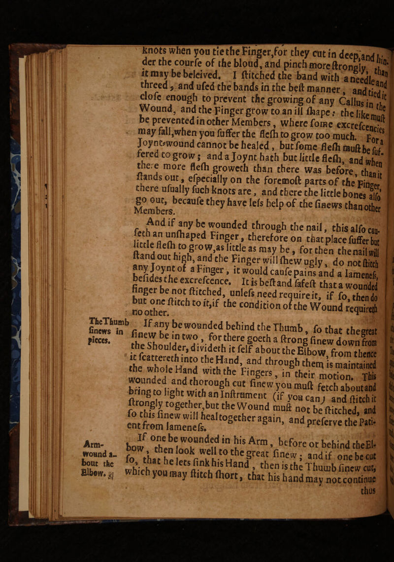 *™ y^u utuniuigcijiui tucy cue in acen.aiiff f,- der the courfe of the bloud, and pinch moreftronovj?a it may be beleived. I ditched the band with a threed, and ufed the bands in the beft manner and tiff* dofc enough to prevent the growing of any Callus in If Wound, and the Finger grow to an ill fhape.- the like Jl* be prevented in other Members, where fome excrefeenr^ * ™ay fab,when you fuffer the flelh to grow too much. Joyncnvound cannot be healed, but fome flefti rauft be cJ fered co grow; and a Joynt hath but little flefh, and when the.e more flefli groweth than there was before thJi! dands out, efpeciallyon the foremoft parts of theVinser there ufually fuch knots are, and there the little bones fir* Members * ** ^ kiS °f che fiflews ^another TWiei fhro,uSb the nail, this alfo catt. uctkflelh to grow,as little as may be, for then thenail will aFi.n§er> i^ouldcaufepa.IsandaS finlr b^oTmLhM- beft/d fafeft th3t a wo““W nnger oe not Ititched, unlefs need reauire it if f« jn b:xfti tch to ,c’,f 2£hbfinew betTI’Urab• foth« thegreat the Shoulder di’d L °reil°?b a ®ron6 finew down fro« it fcittme,dMn.i uh .rdf a,bo“t the Elb°W, from thence the whole Hand with .\nd,B“d throuSh them is maintained toe wiiole Hand with the Fingers, in their motion This Mnfitodeahntdwi,°ha“fhftflBeWy?Umuft fetchab°“t»nd ftrongiy together,but the Wonnd Lft not be ftftched and fo this finew will healtosether anain V nfdV • entfrem lamenefs. 8 6 ’ and preferve the Pan- thus pieces, Arm- wound a. bout the Elbow, gj