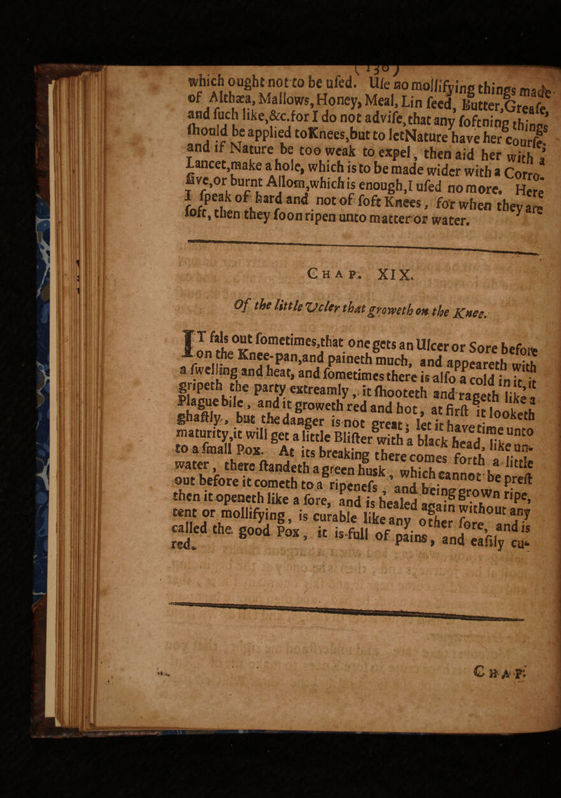 which oughtnotto be ufed. life aomollifying thin** m**. »f Alt tea Mallows, Honey, Meal, Lin feed, £S and fuch like,&c for I do not advife,that any foftniog tfZ,* fhonld be applied toKnees,but to IetNature have her cour|? and if Nature be too weak to expel * then aid her with 1 lancet,make a hole, which is to be made wider with a Corm ve,or_ burnt Allotn which is enough,I ufed no more. Here Unf °lfearr and •n0t of foft Knets ’ fot whetJ they are foft, then they foon ripen unto matter or water. e h a p. xix. Of the little 'Oder thatgroweth oh the Knee. In °fget! an U,cer or before _on the Knee-pan,and paineth much, and appeareth with ^ ;'!VBRand heat»and Sometimes there is alfo a cold in it it i IS thKCrhe paf? cxtreamly, it fiiooteth and rageth like , maturity it will get a little Blifer w l ’a Mack UnC° :°lfrl[P0*» f brakig ‘“m2 forfh“5£ out hrfoi ? ftandKth aSreenhusk. which cannot be nreft then it openeth like a fore, and is heafed ^gcown r,pe, called the. good Pox, it is-ftU of Jins »nH ri d“ red,. pains, and eafily cu* /