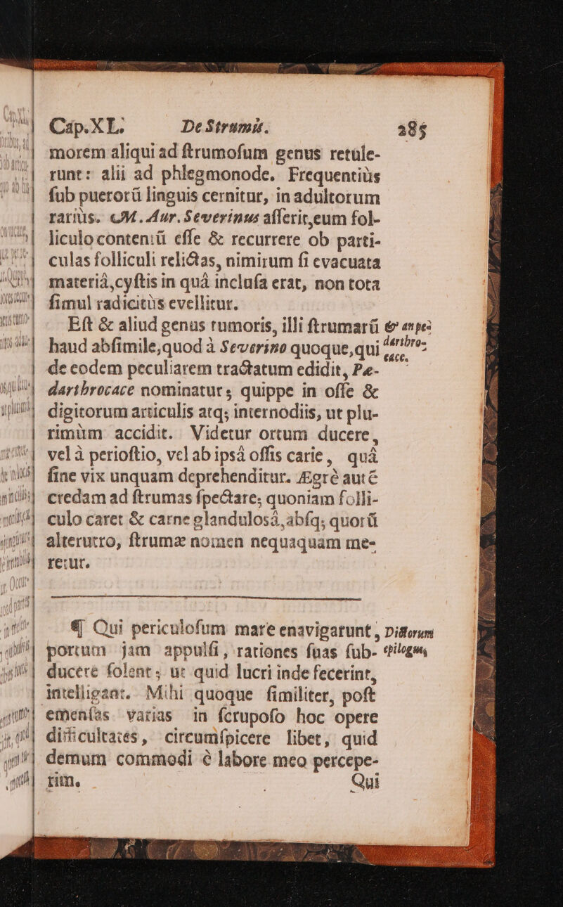 Cip.XL. De Strumi. 38$ | morem aliqui ad ftrumofum genus retüle- | runt: alii ad phlegmonode. Frequentiüs | fub puerorü linguis cernitur, in adultorum - | rarius. &amp;M. Aur. Severinus afferit,eum fol- ^| liculoconten:ü effe &amp; recurrere ob parti- | culasfolliculi relictas, nimirum fi cvacuata | materia,cyftis in quà incluía erat, non tota | fimul radicitüs evellitut. USI - ERft&amp; aliud genus tumoris, illi ftrumarü € «npe: /*| baud abfimile,quod à Severize quoque,qui ^^^: | decodem peculiarem tractatum edidit, Pe- —— WI dartbrocace nominaturs quippe in offe &amp; | digitorum articulis atq; internodiis, ut plu- | rimüm accidit. Videtur ortum ducere, /'| velà perioftio, velabipsáoffis carie, quà 119] fine vix unquam deprehenditur. gré aut 1105] credam ad ftrumas fpeGtare; quoniam filli- 35] culo caret &amp; carne glandulosá, abfq; quorü j^ alterutro, ftrumz noinen nequaquam me- jm] rerut. €| Qui periculofum mare enavigatunt , Distorum | portum jam appulft, rationes fuas füb- thiloges j^] ducere folent; ut quid lucri inde fecerint, | intelligant, Mihi quoque fimiliter, poft '] emen(as. varias 1a fcrupofo hoc opere | diriculta:es, circumifpicere libet, quid 40/| demum commodi é labore meo percepe- i rim. | Qui